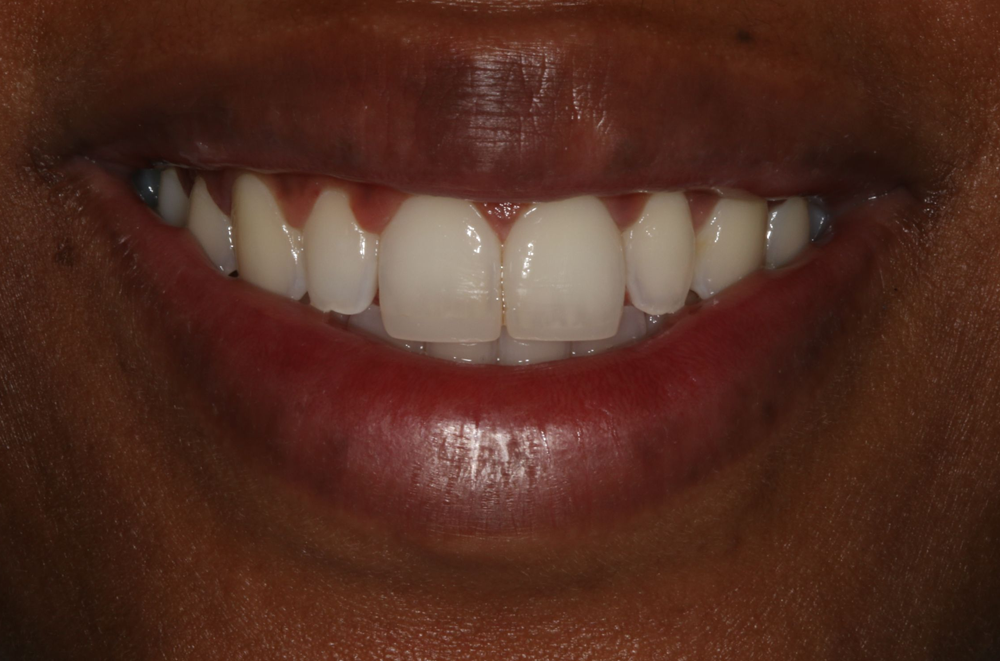 Georgetown Cosmetic Dentistry Georgetown Cosmetic Dentistry