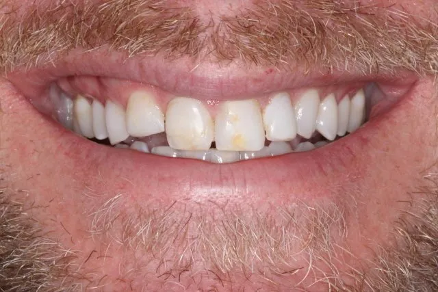 Georgetown Cosmetic Dentistry Georgetown Cosmetic Dentistry