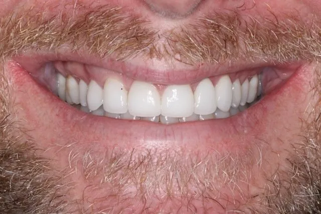 Georgetown Cosmetic Dentistry Georgetown Cosmetic Dentistry