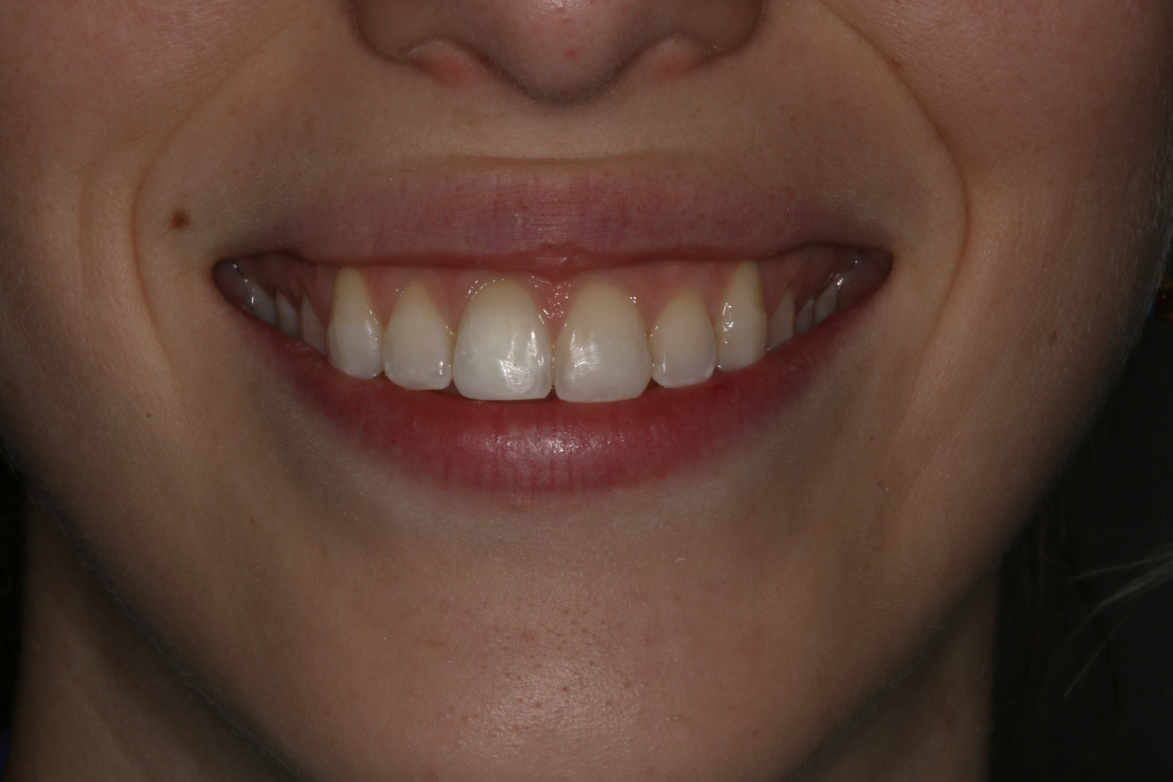 Georgetown Cosmetic Dentistry Georgetown Cosmetic Dentistry