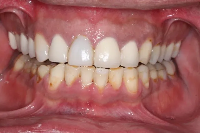 Georgetown Cosmetic Dentistry Georgetown Cosmetic Dentistry