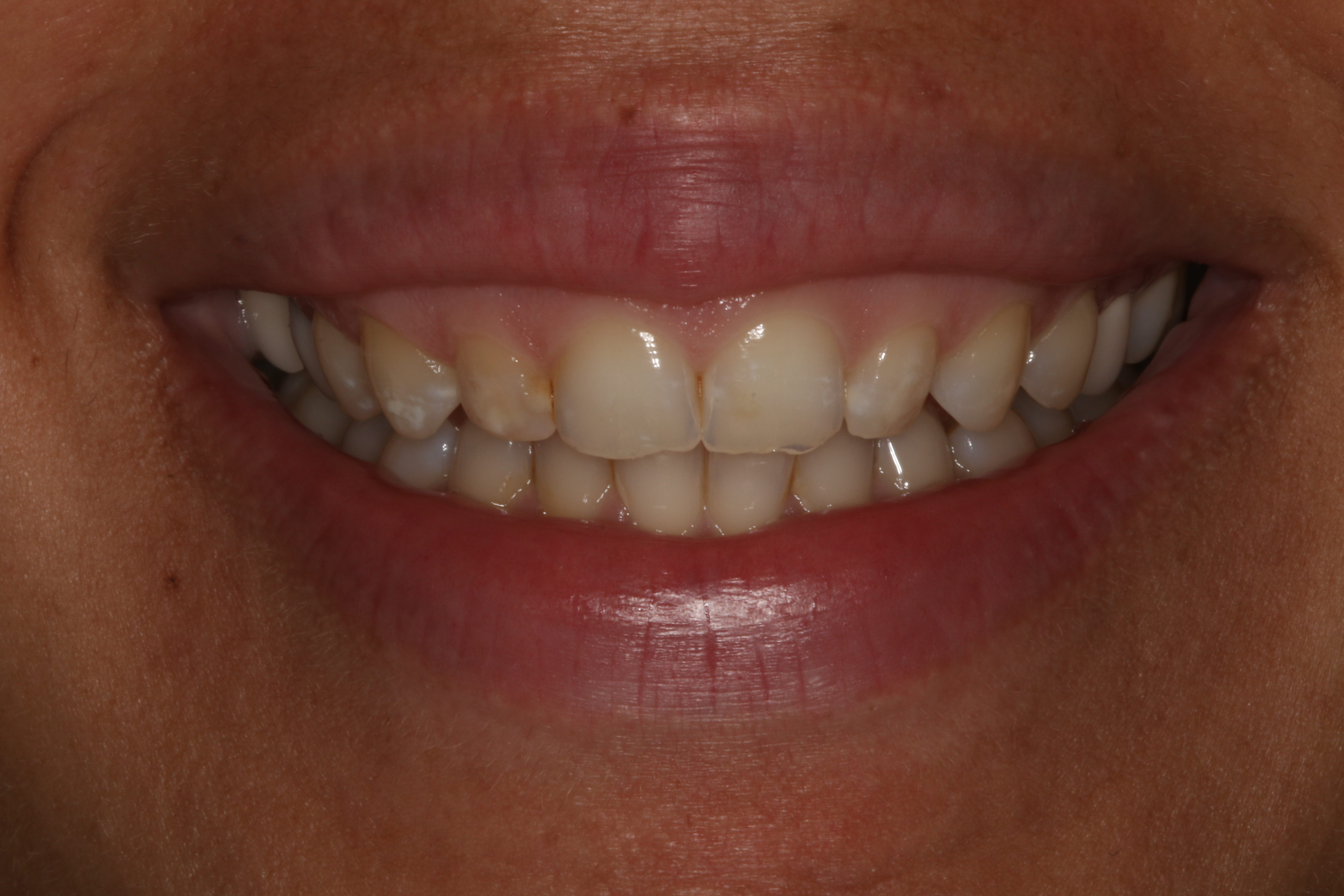 Georgetown Cosmetic Dentistry Georgetown Cosmetic Dentistry