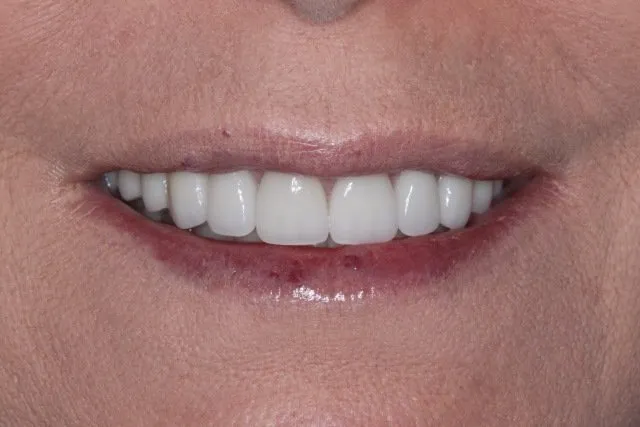 Georgetown Cosmetic Dentistry Georgetown Cosmetic Dentistry