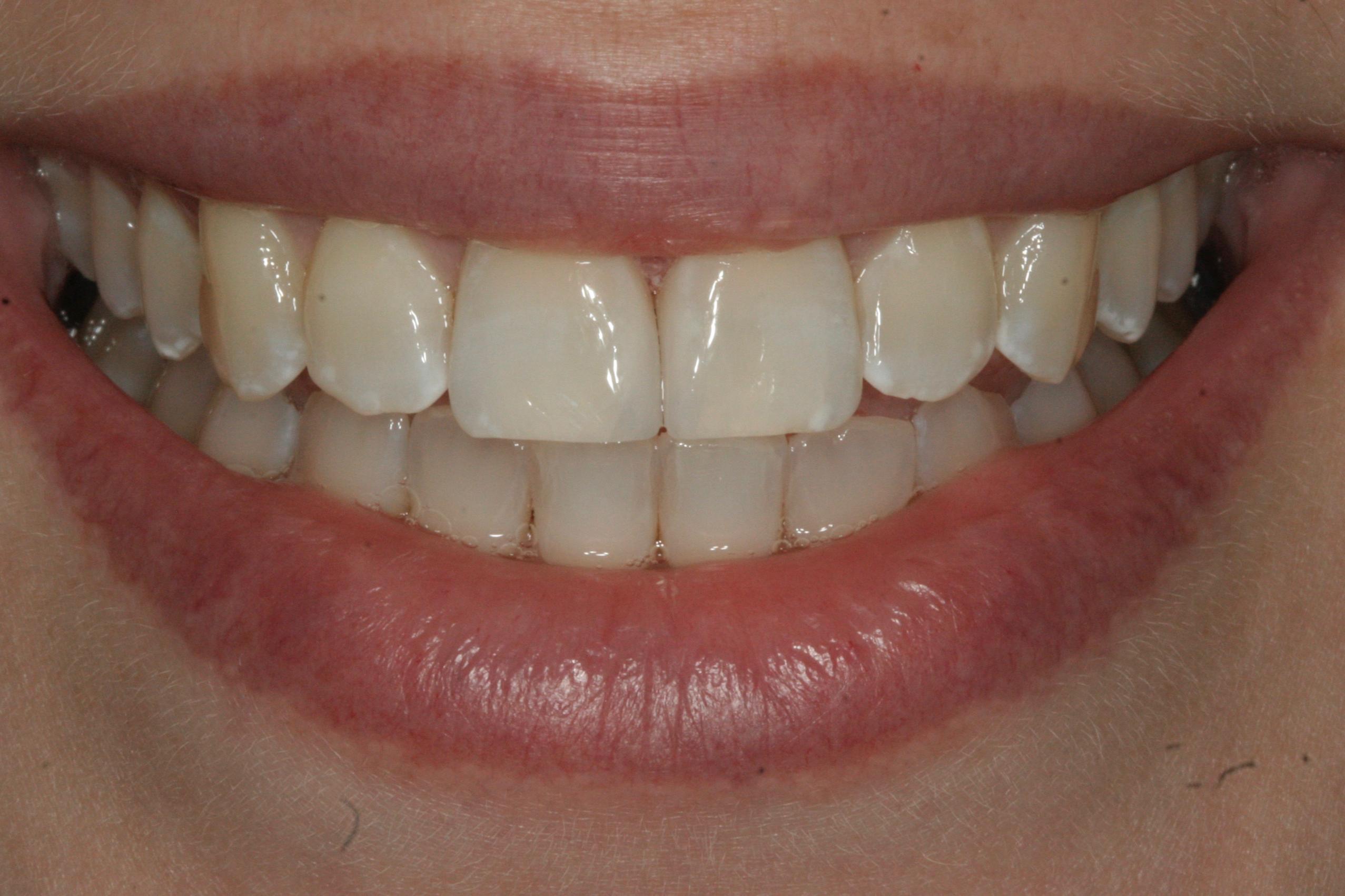 Georgetown Cosmetic Dentistry Georgetown Cosmetic Dentistry