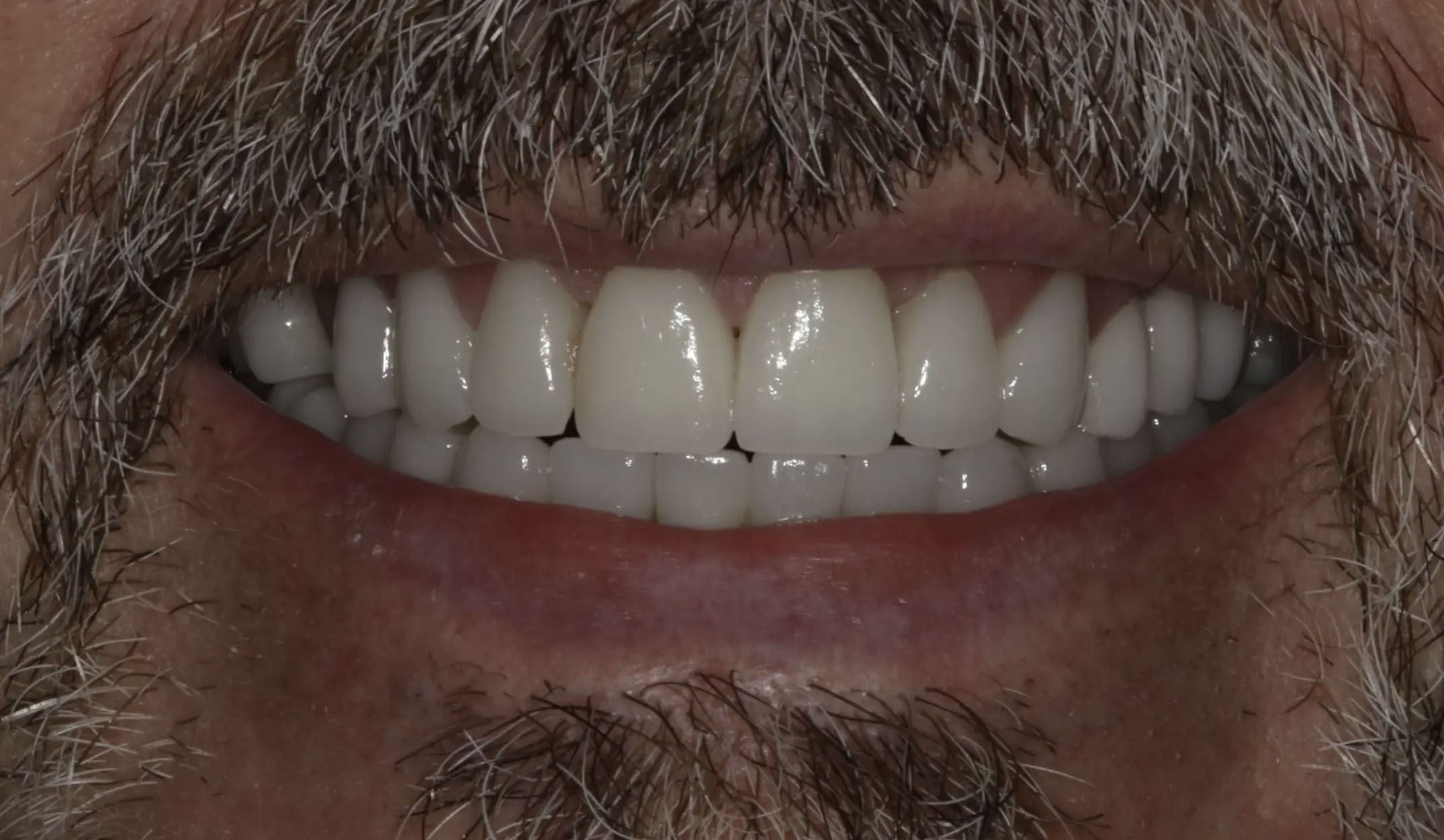 Georgetown Cosmetic Dentistry Georgetown Cosmetic Dentistry