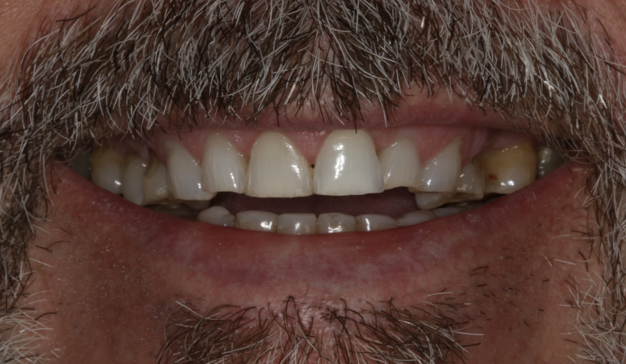 Georgetown Cosmetic Dentistry Georgetown Cosmetic Dentistry