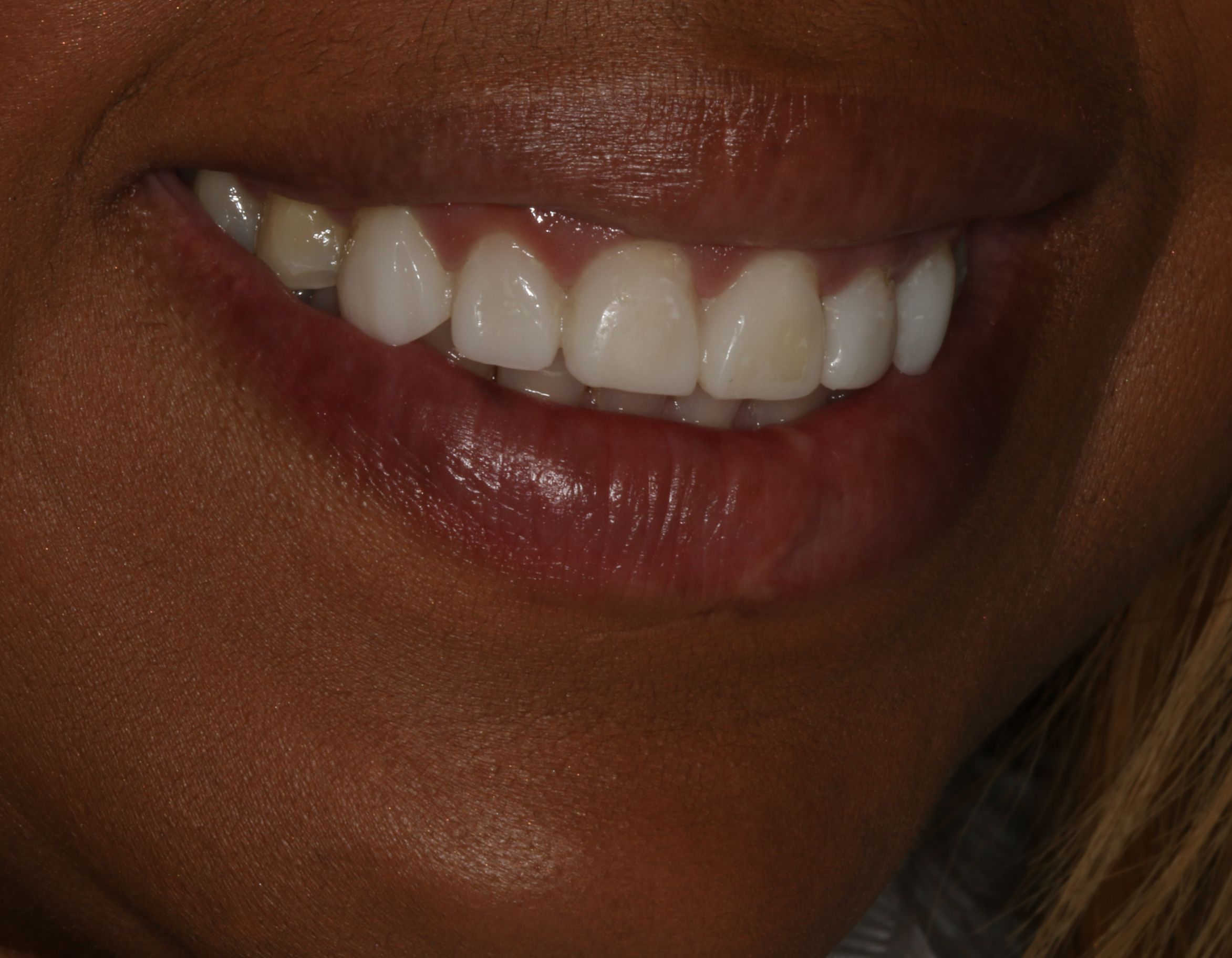 Georgetown Cosmetic Dentistry Georgetown Cosmetic Dentistry