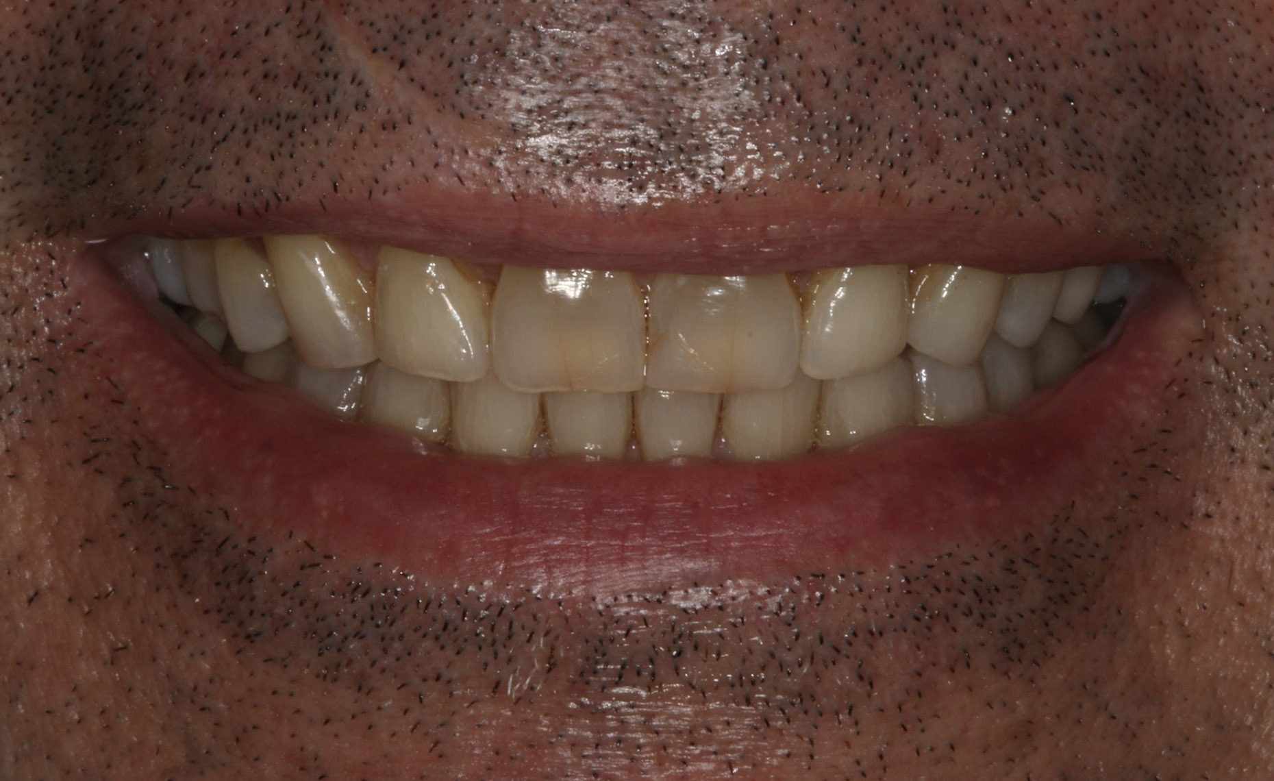 Georgetown Cosmetic Dentistry Georgetown Cosmetic Dentistry