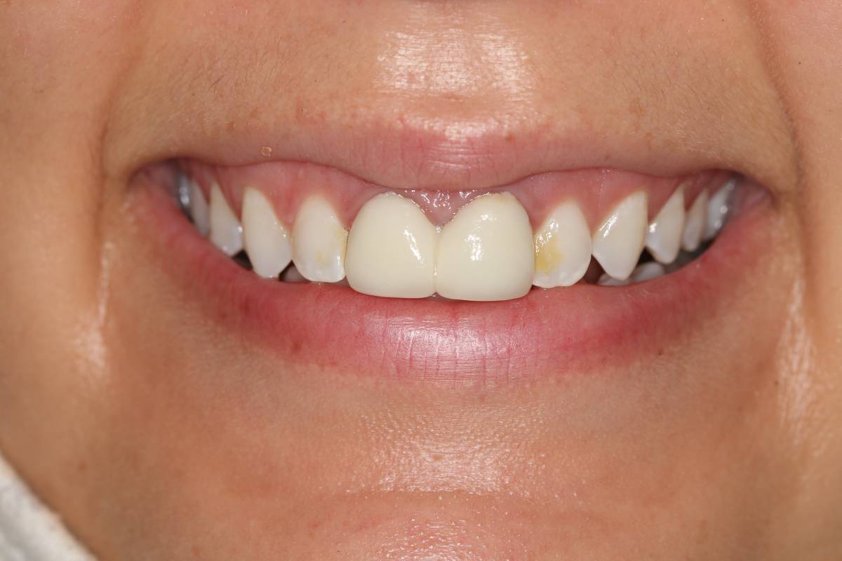 Georgetown Cosmetic Dentistry Georgetown Cosmetic Dentistry