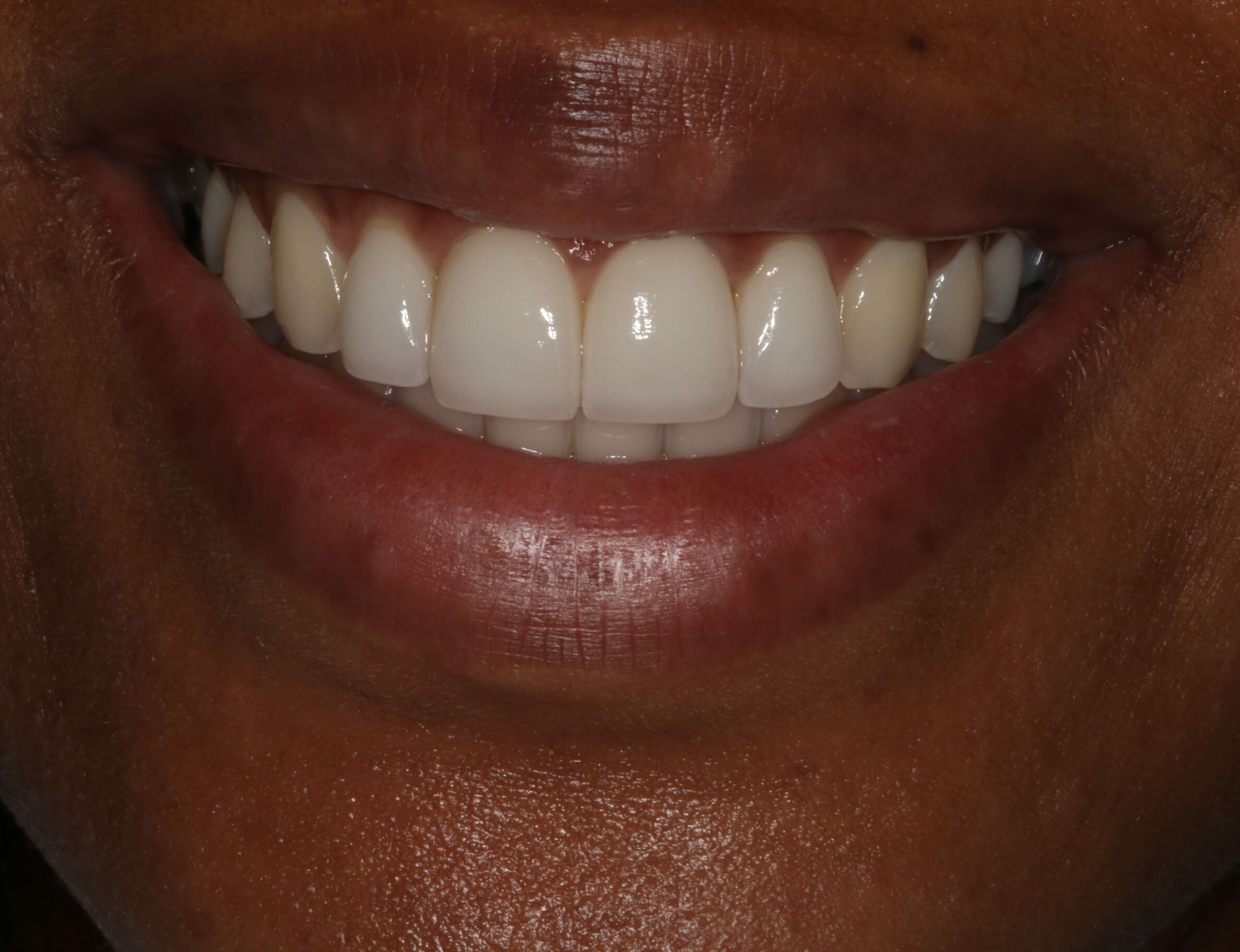 Georgetown Cosmetic Dentistry