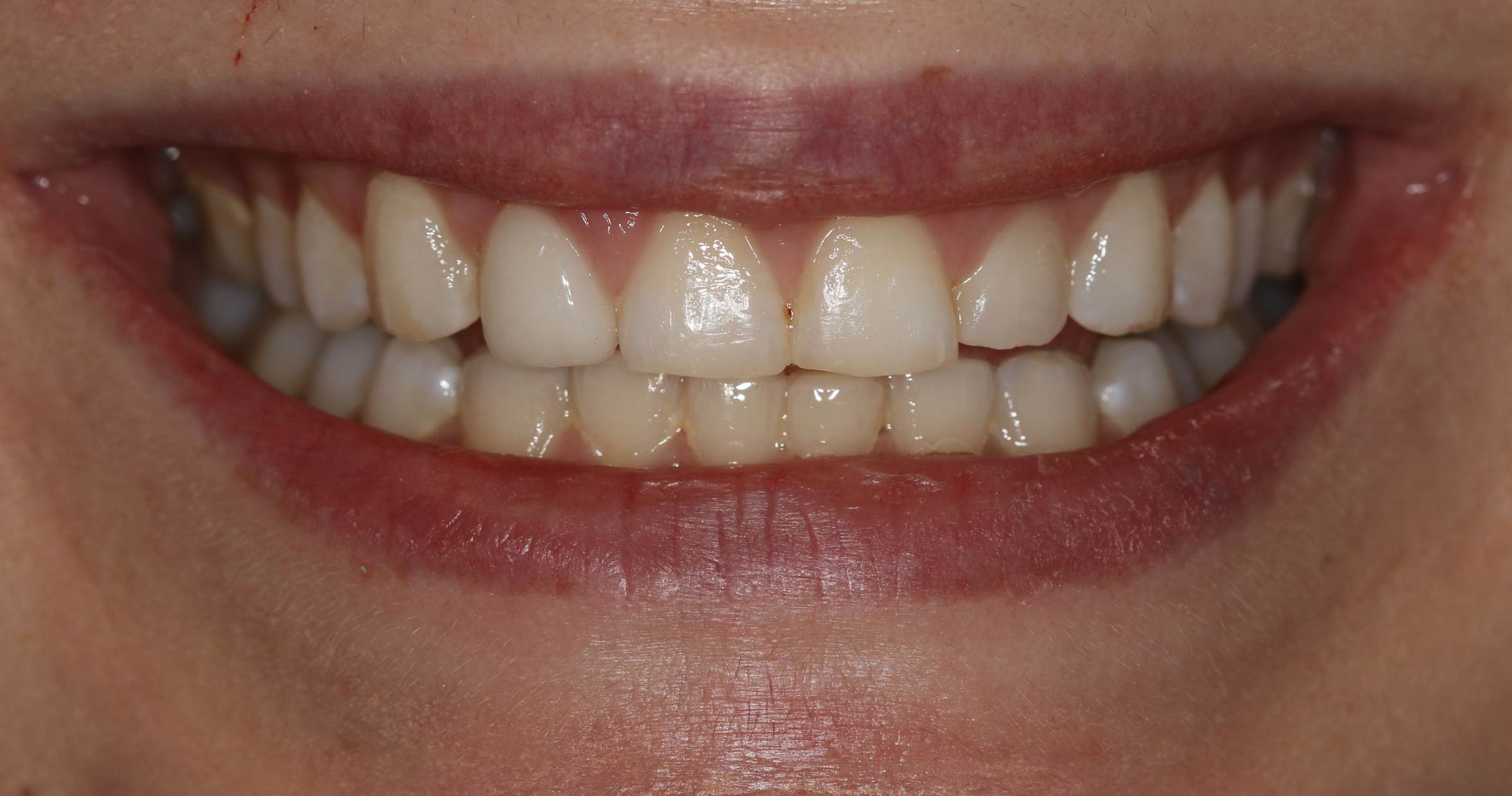 Georgetown Cosmetic Dentistry Georgetown Cosmetic Dentistry