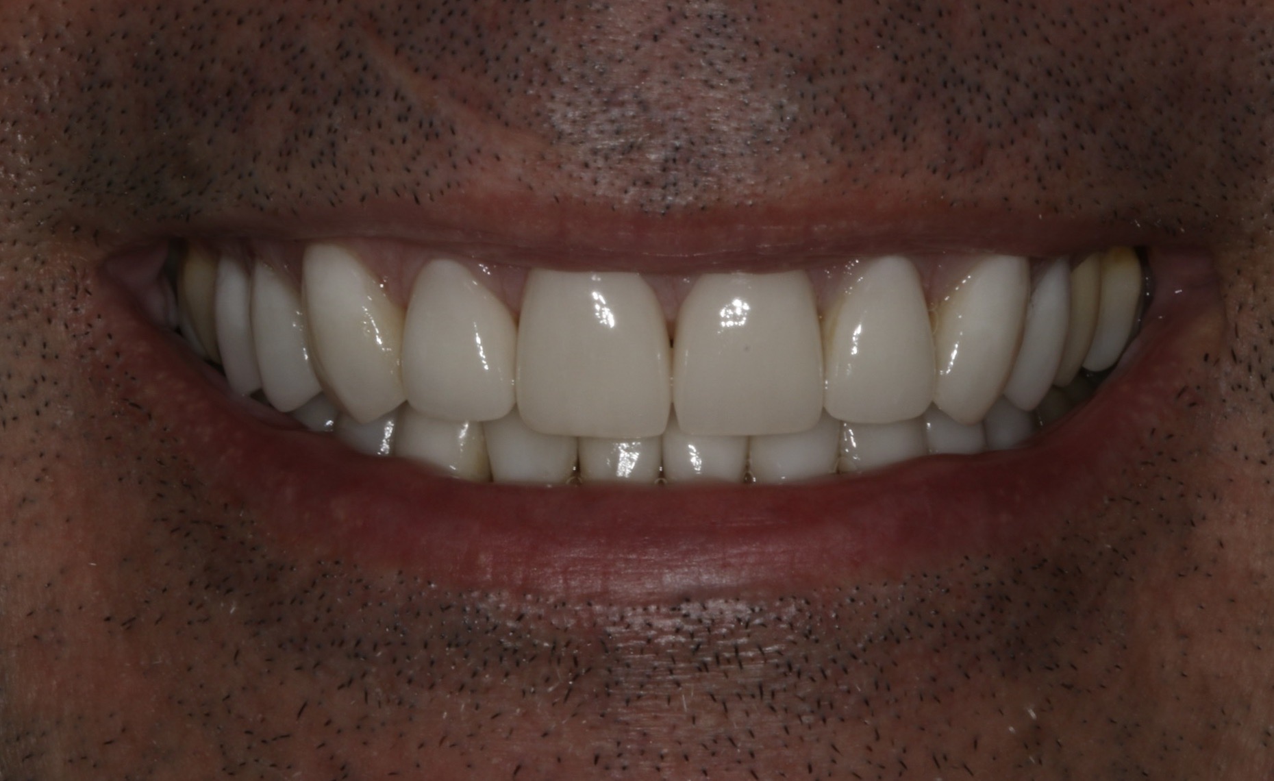 Georgetown Cosmetic Dentistry Georgetown Cosmetic Dentistry