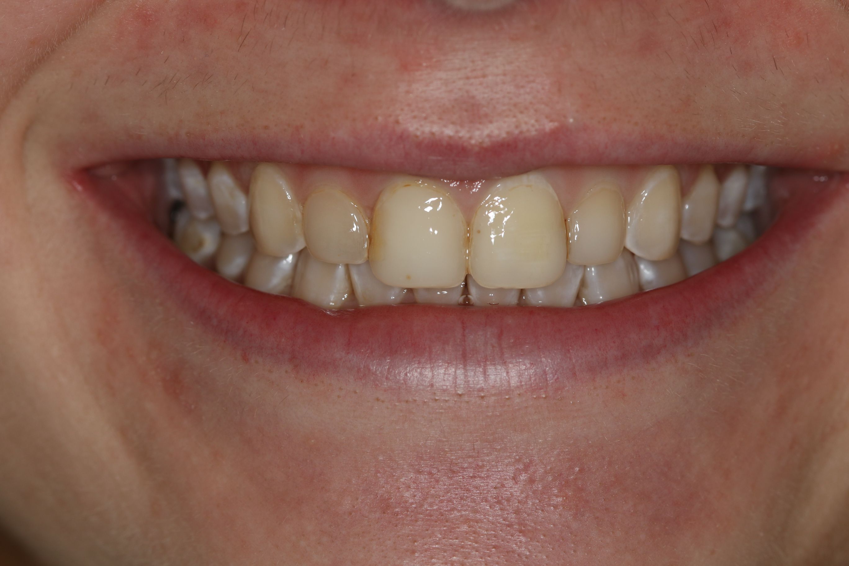 Georgetown Cosmetic Dentistry