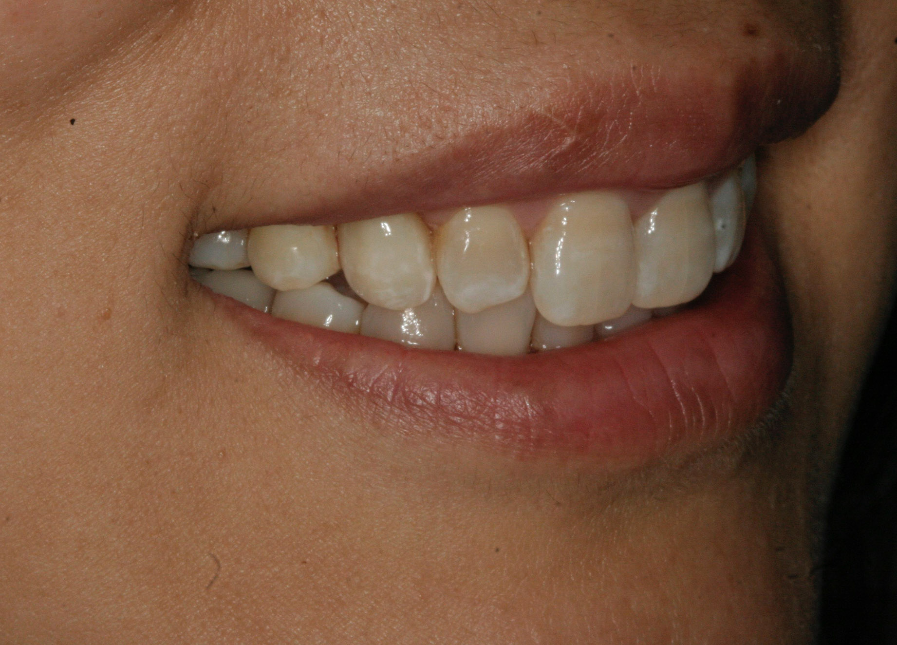 Georgetown Cosmetic Dentistry Georgetown Cosmetic Dentistry