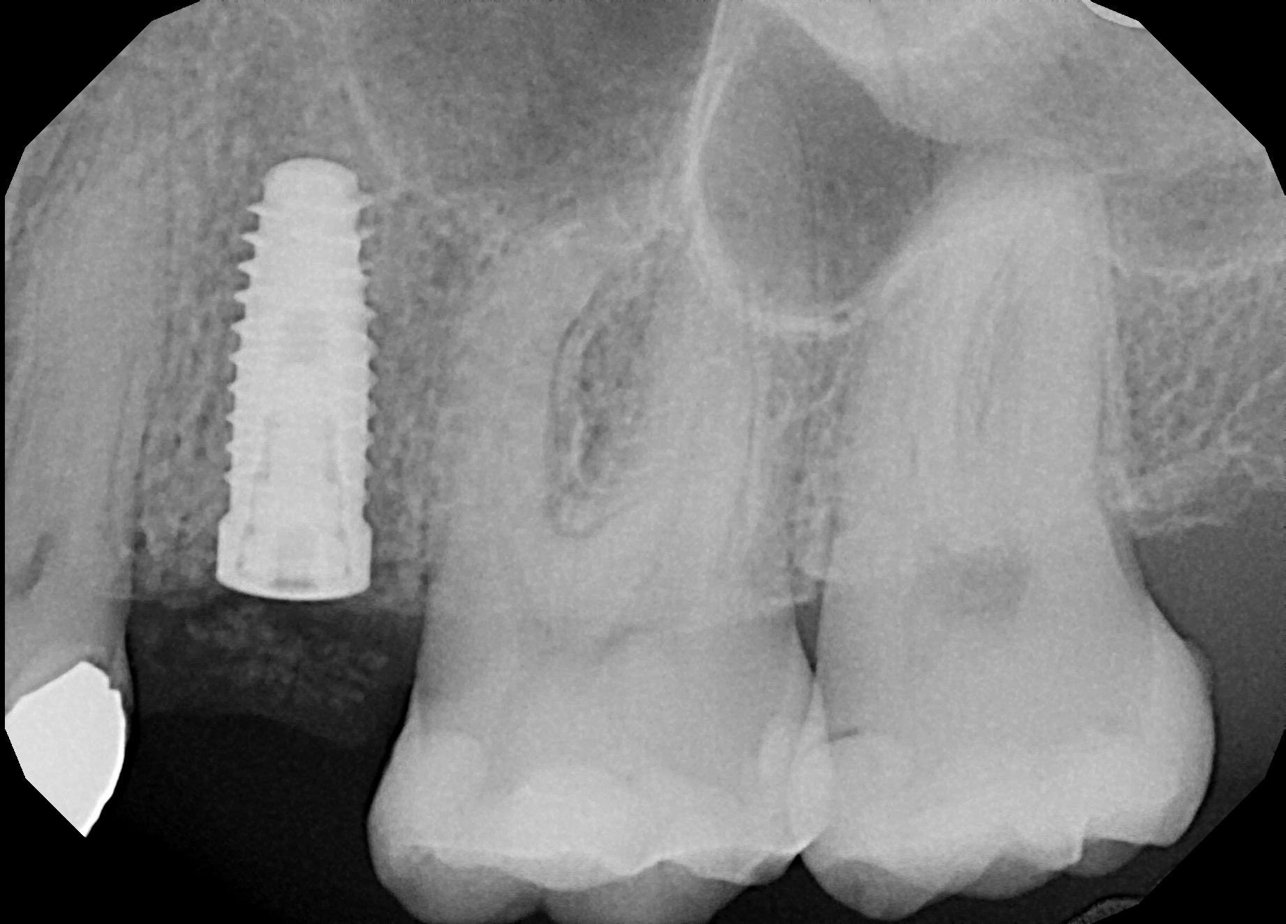 Georgetown Cosmetic Dentistry Georgetown Cosmetic Dentistry