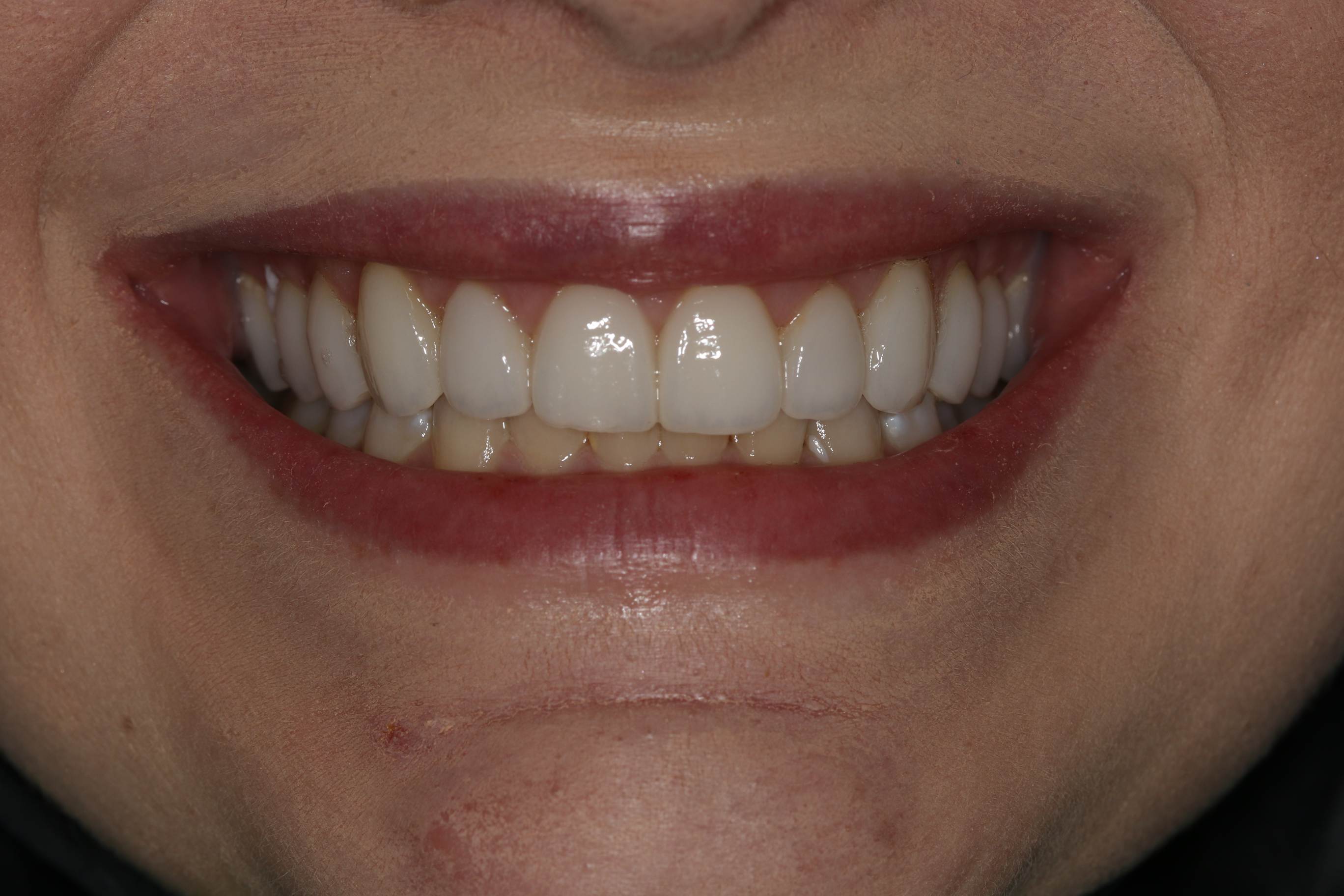 Georgetown Cosmetic Dentistry