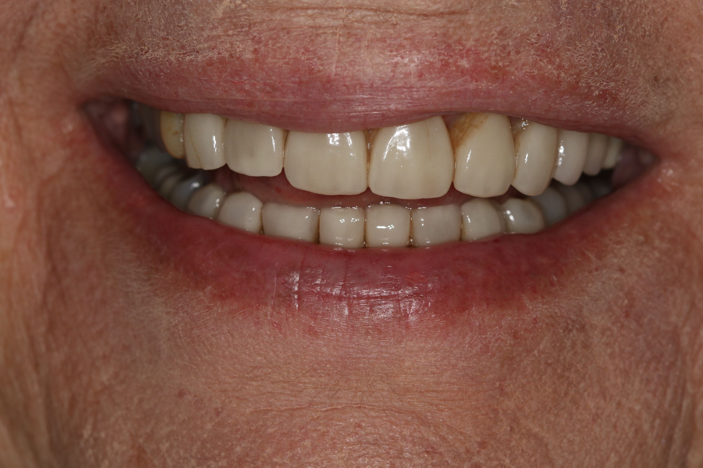 Georgetown Cosmetic Dentistry Georgetown Cosmetic Dentistry