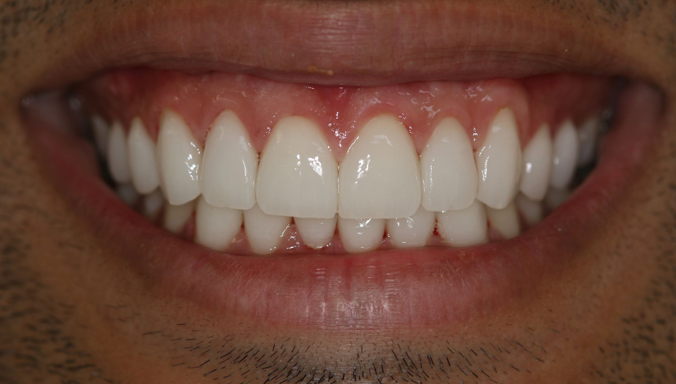 Georgetown Cosmetic Dentistry