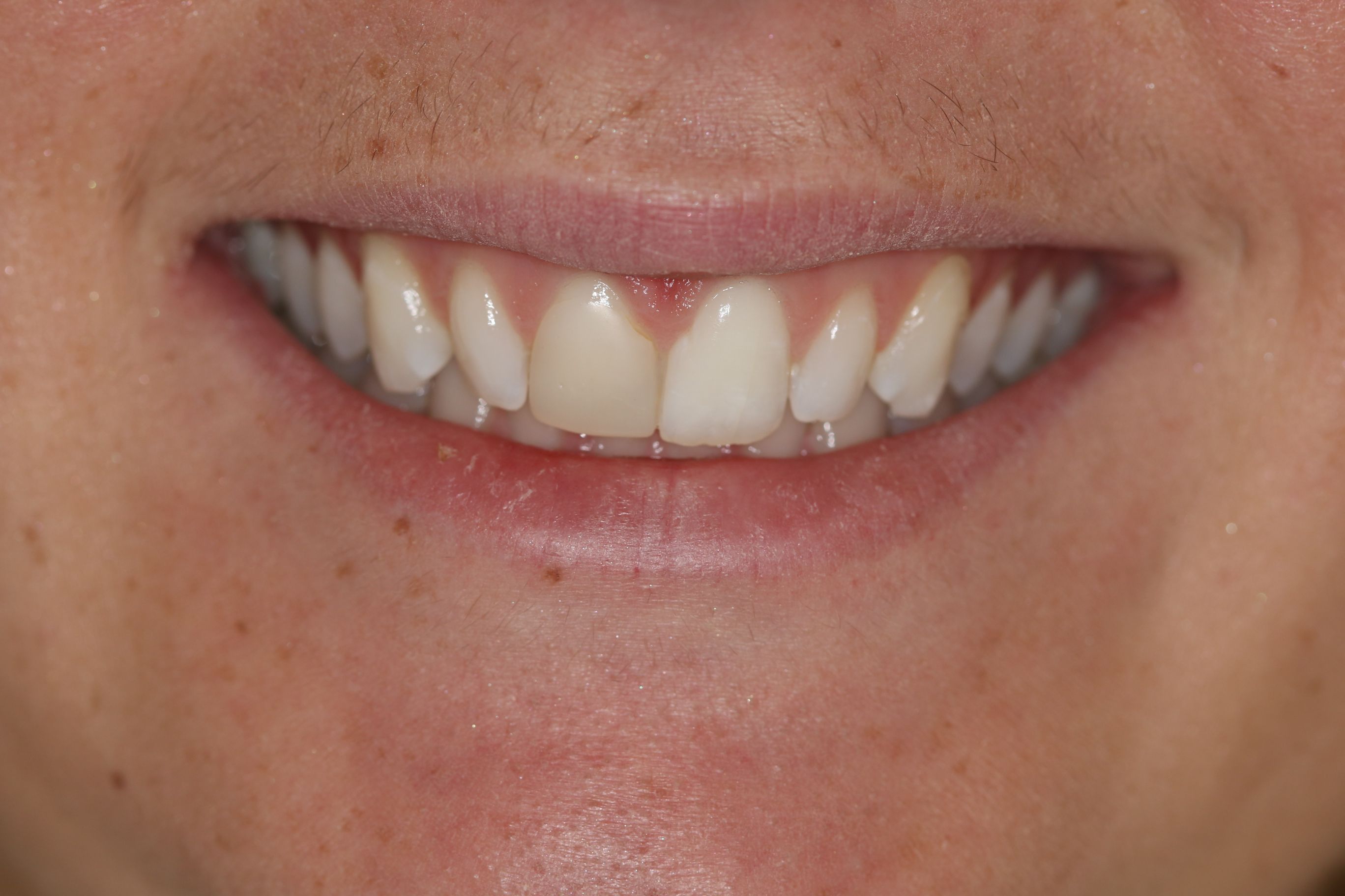 Georgetown Cosmetic Dentistry Georgetown Cosmetic Dentistry