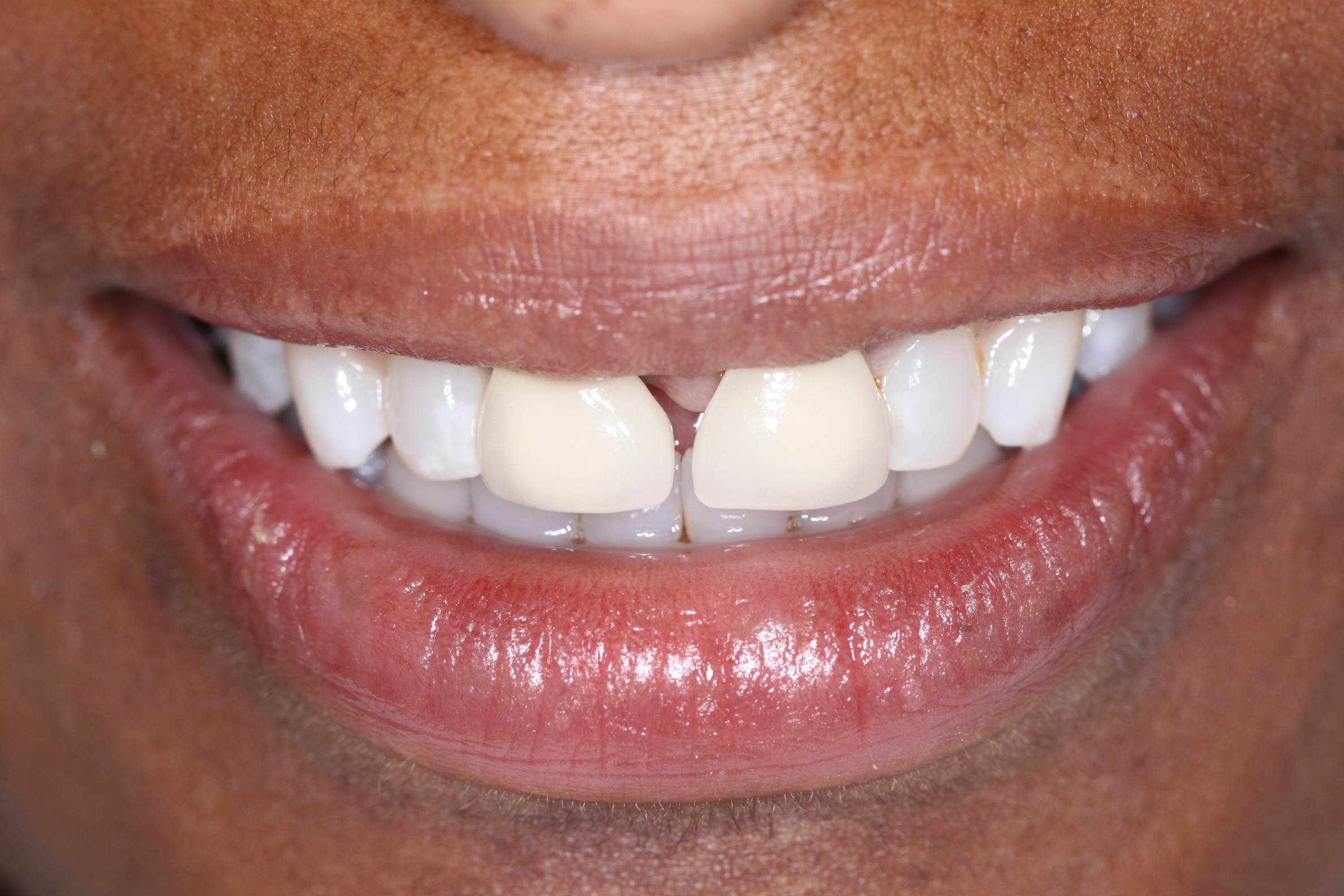 Georgetown Cosmetic Dentistry Georgetown Cosmetic Dentistry