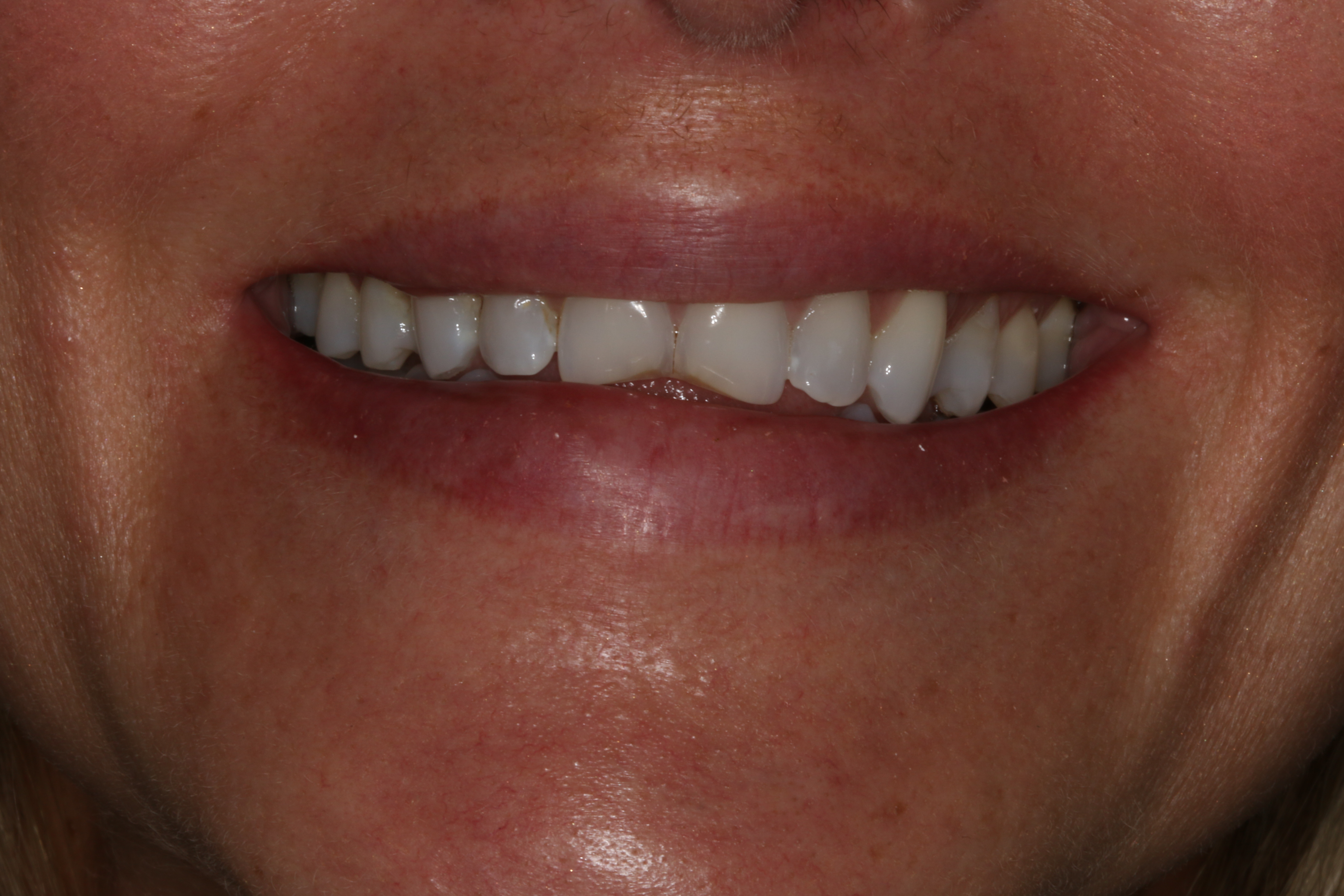 Georgetown Cosmetic Dentistry Georgetown Cosmetic Dentistry
