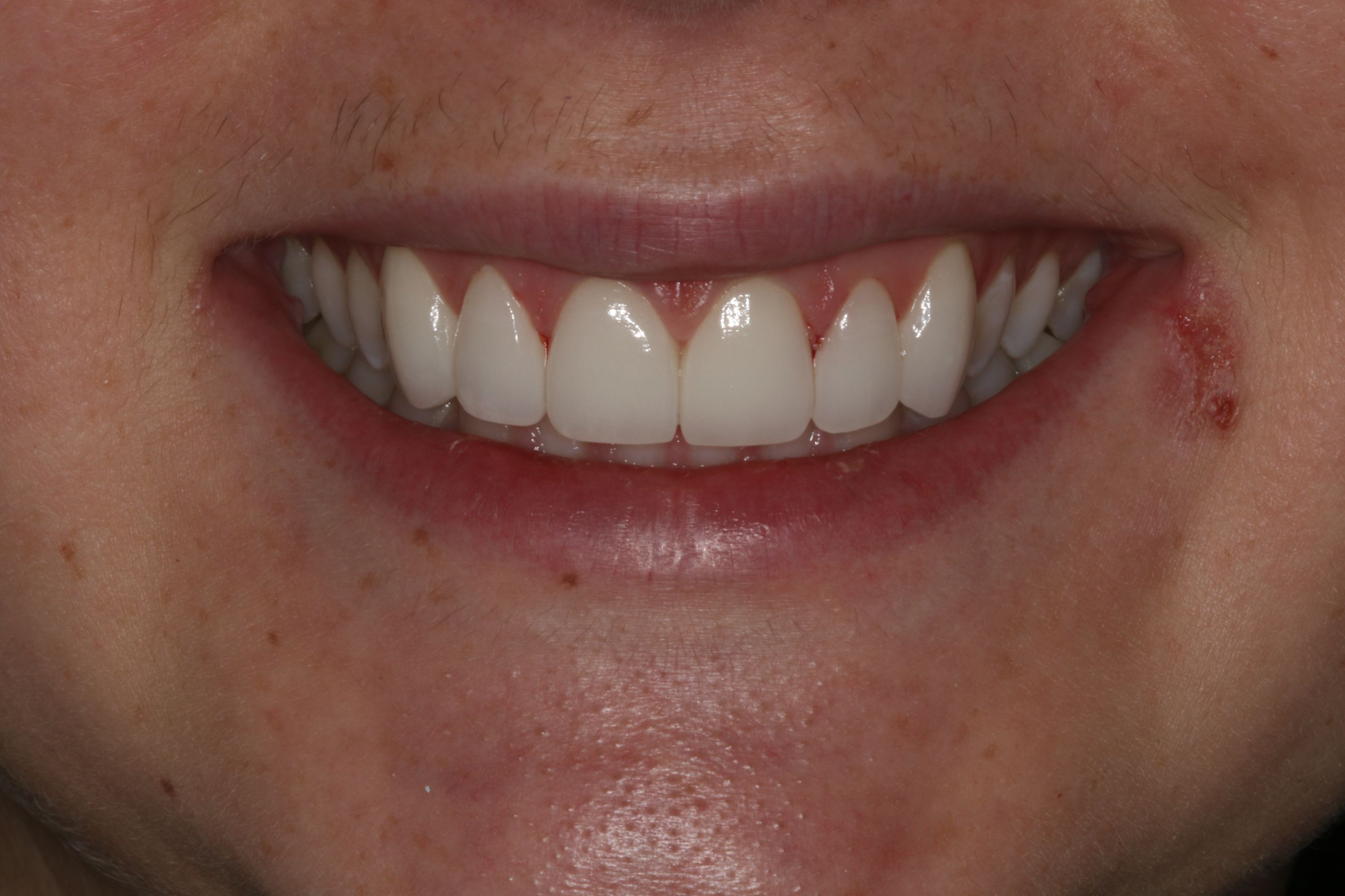 Georgetown Cosmetic Dentistry Georgetown Cosmetic Dentistry
