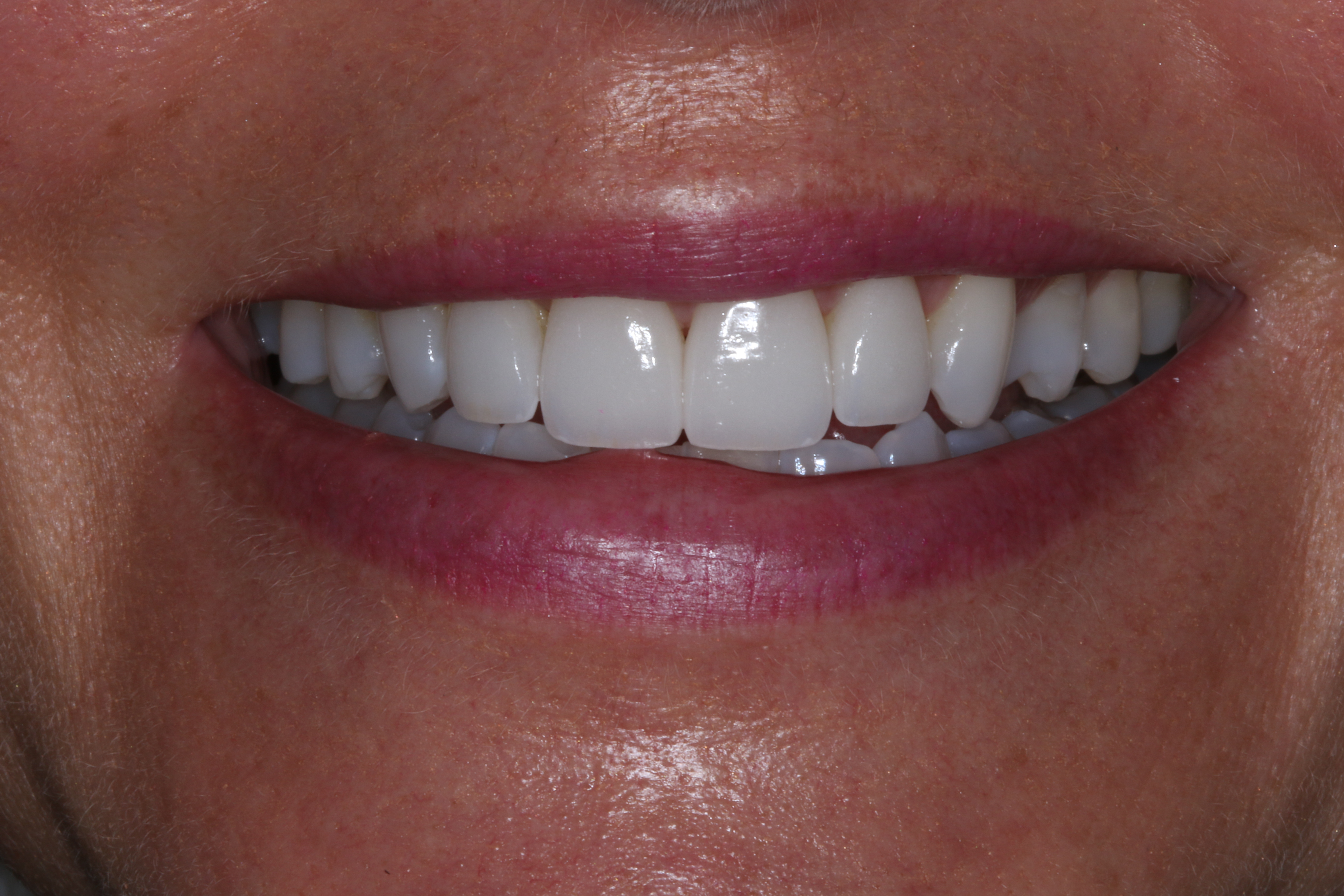 Georgetown Cosmetic Dentistry Georgetown Cosmetic Dentistry