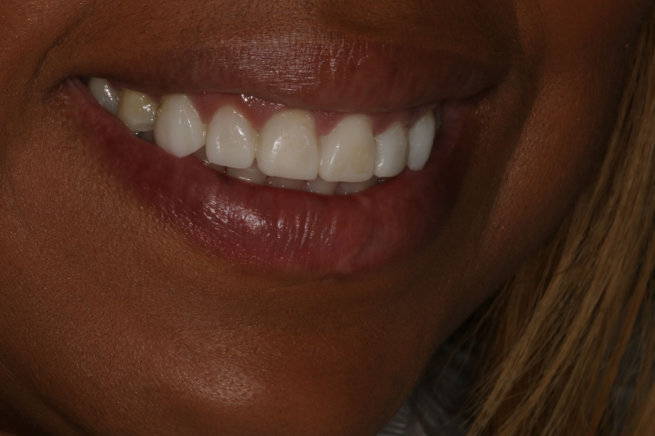 Georgetown Cosmetic Dentistry