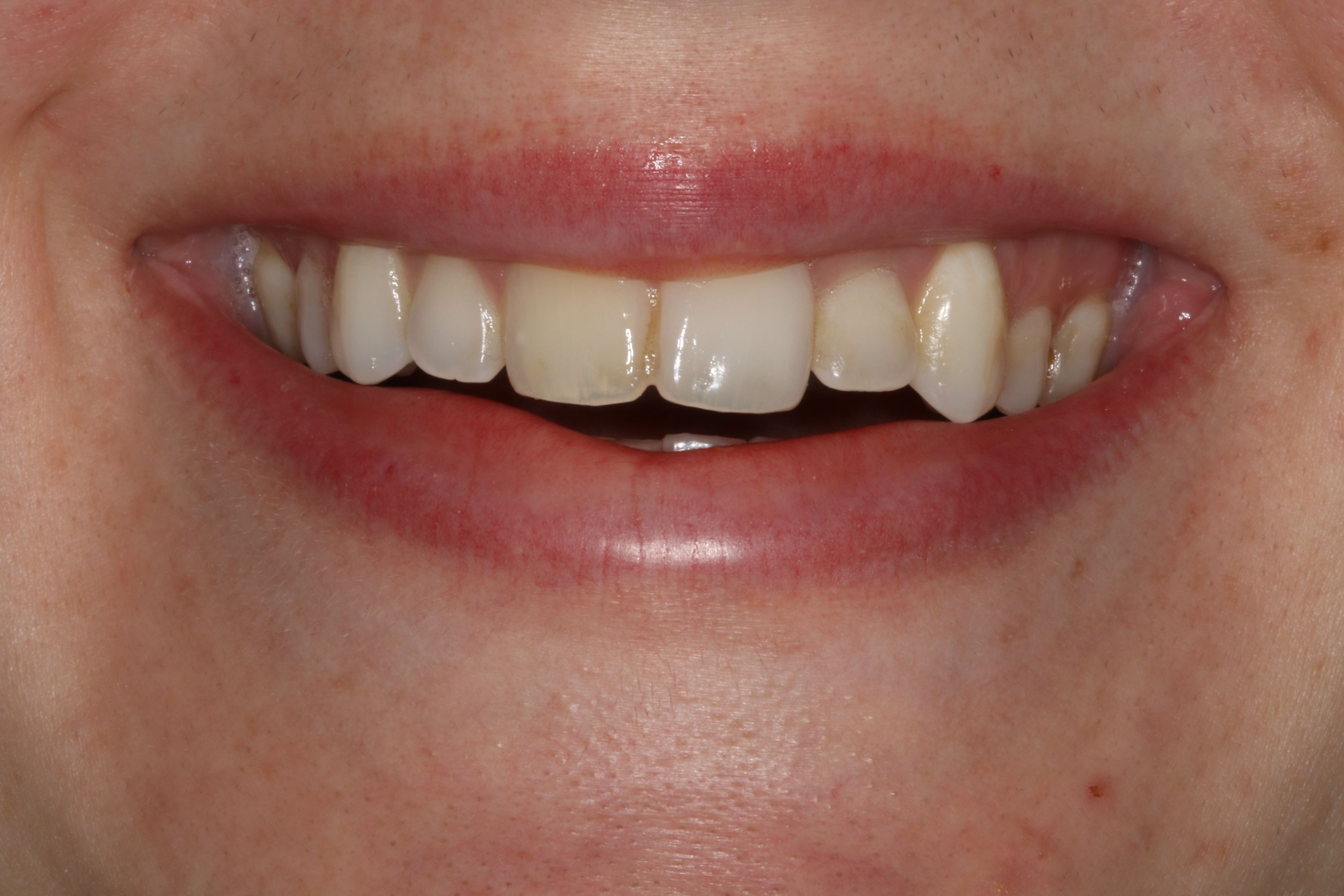 Georgetown Cosmetic Dentistry Georgetown Cosmetic Dentistry