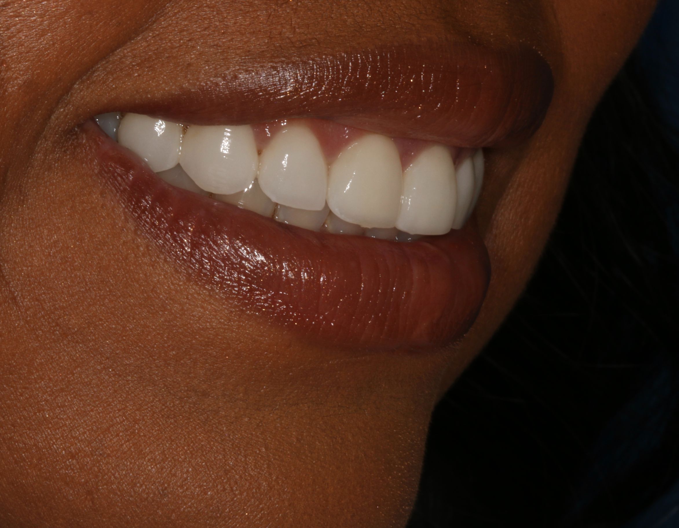 Georgetown Cosmetic Dentistry Georgetown Cosmetic Dentistry