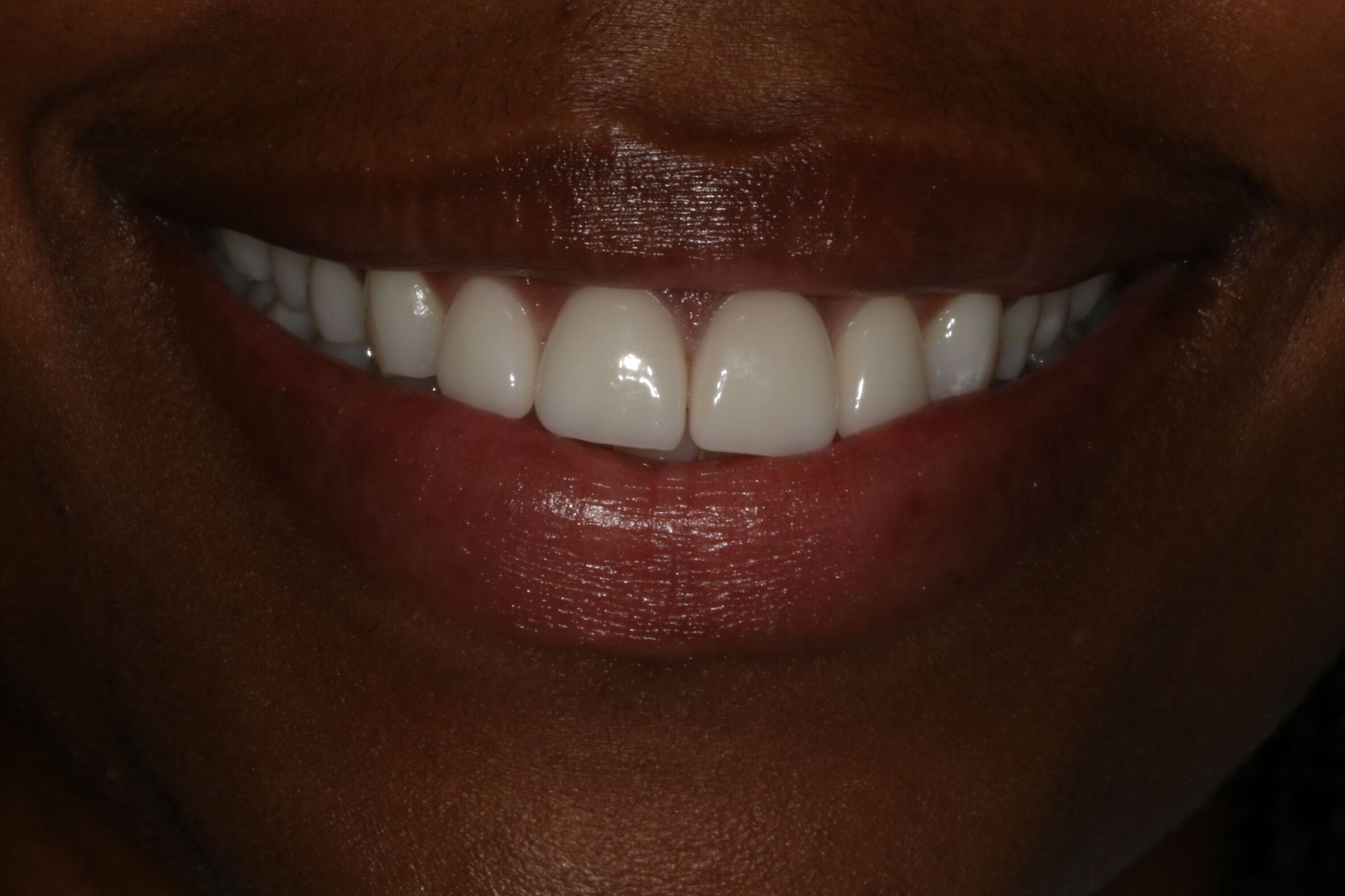 Georgetown Cosmetic Dentistry