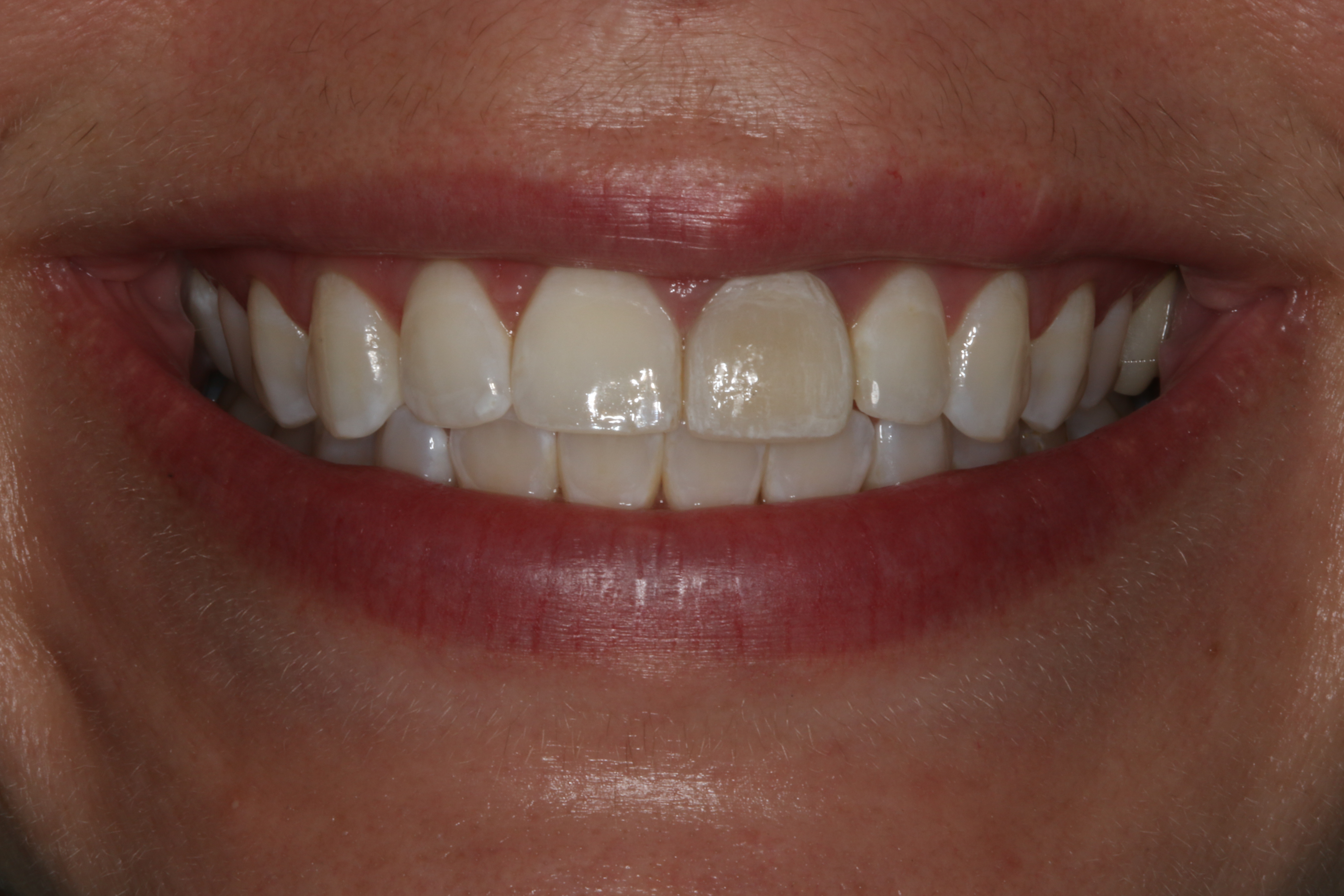 Georgetown Cosmetic Dentistry Georgetown Cosmetic Dentistry