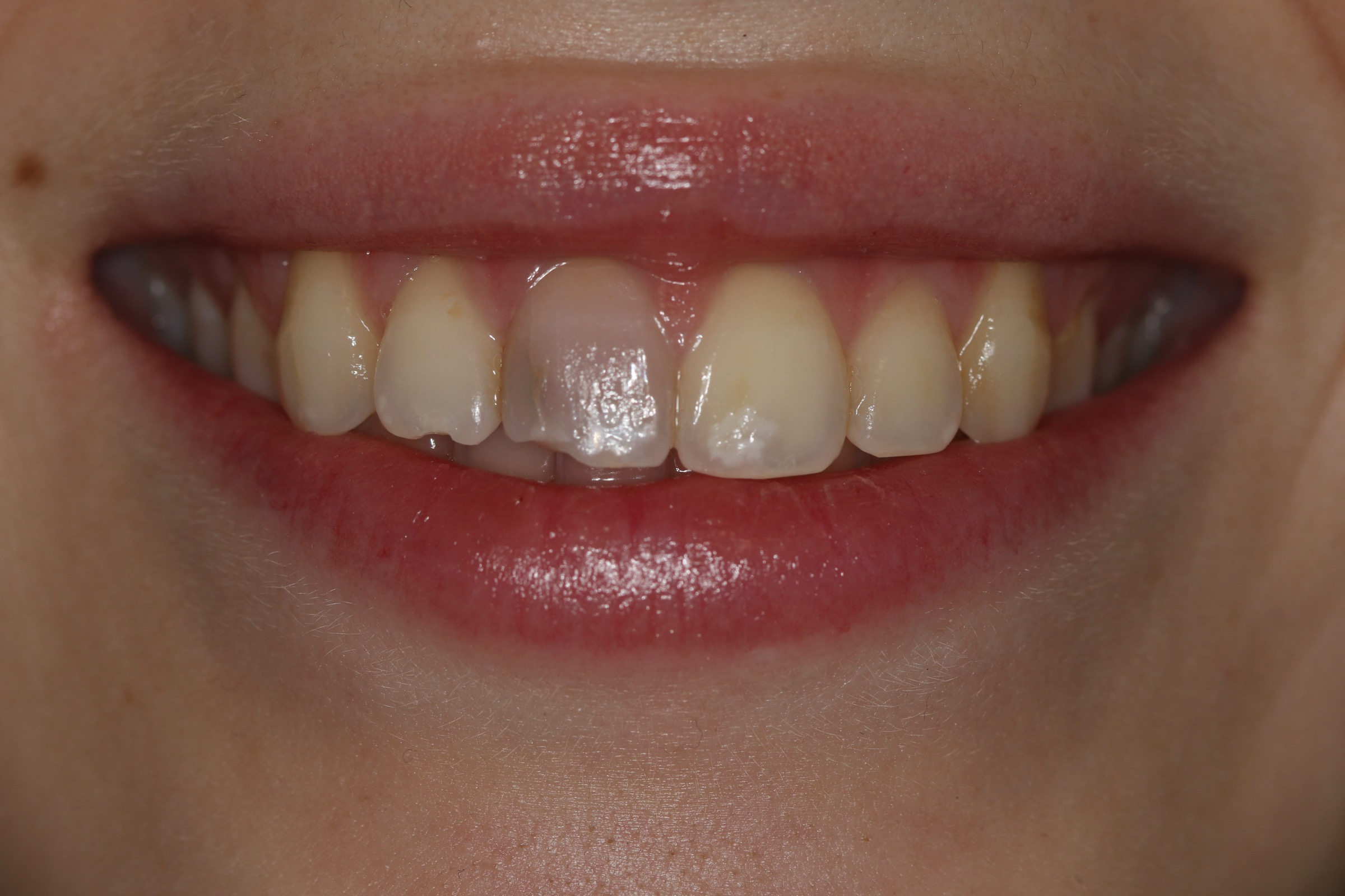 Georgetown Cosmetic Dentistry Georgetown Cosmetic Dentistry