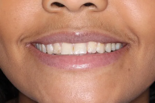 Georgetown Cosmetic Dentistry