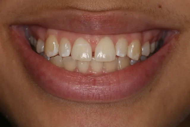 Georgetown Cosmetic Dentistry