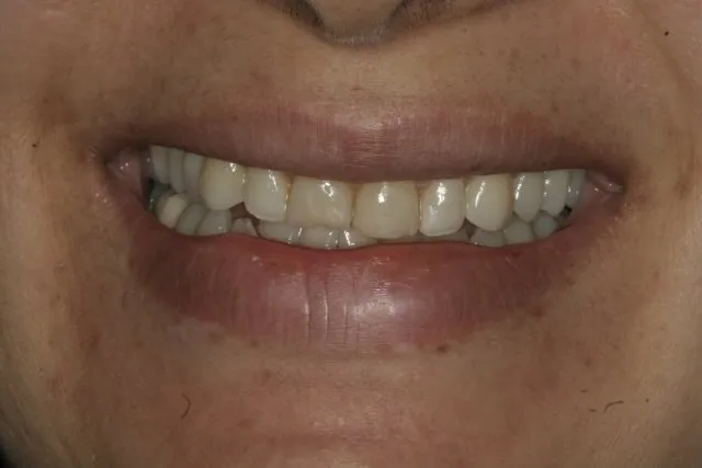Georgetown Cosmetic Dentistry Georgetown Cosmetic Dentistry