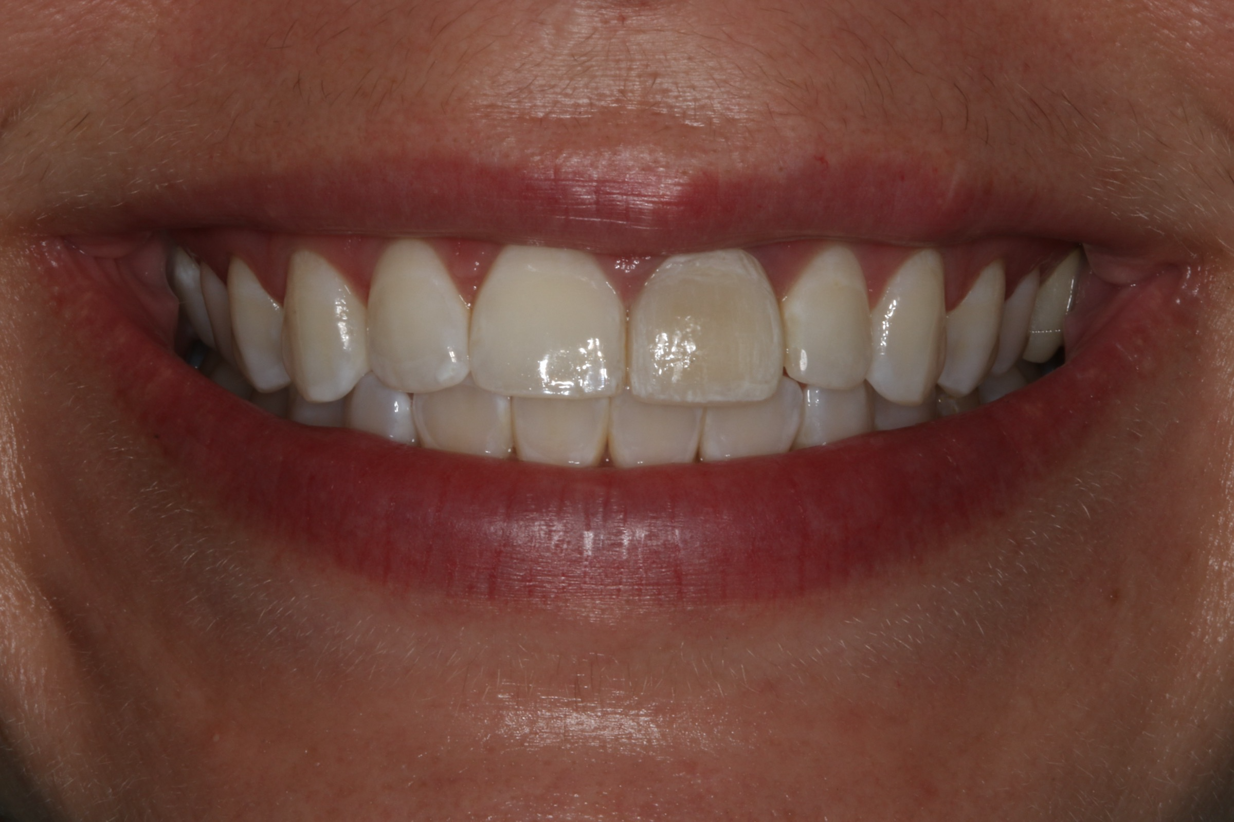 Georgetown Cosmetic Dentistry Georgetown Cosmetic Dentistry