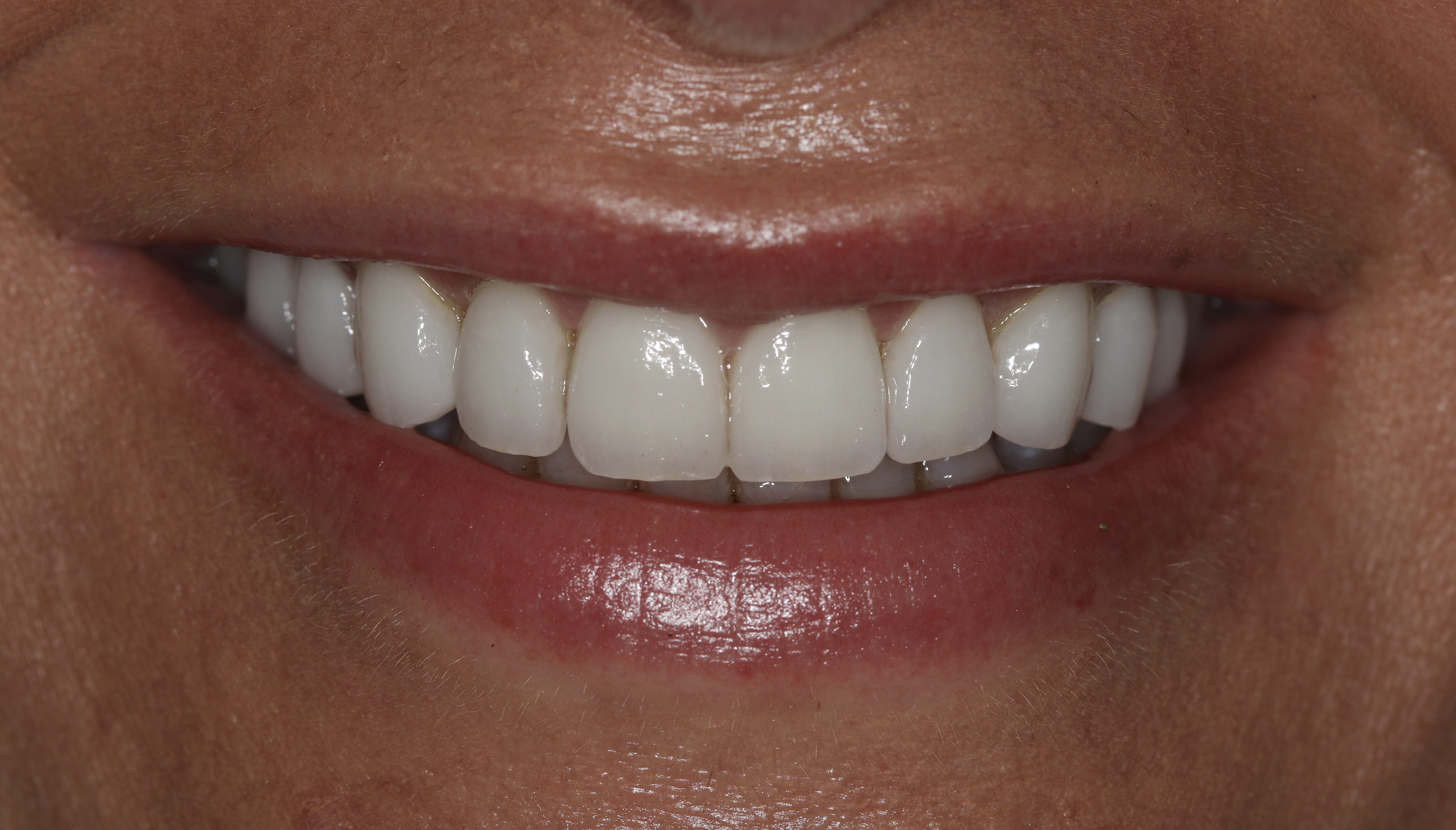 Georgetown Cosmetic Dentistry Georgetown Cosmetic Dentistry