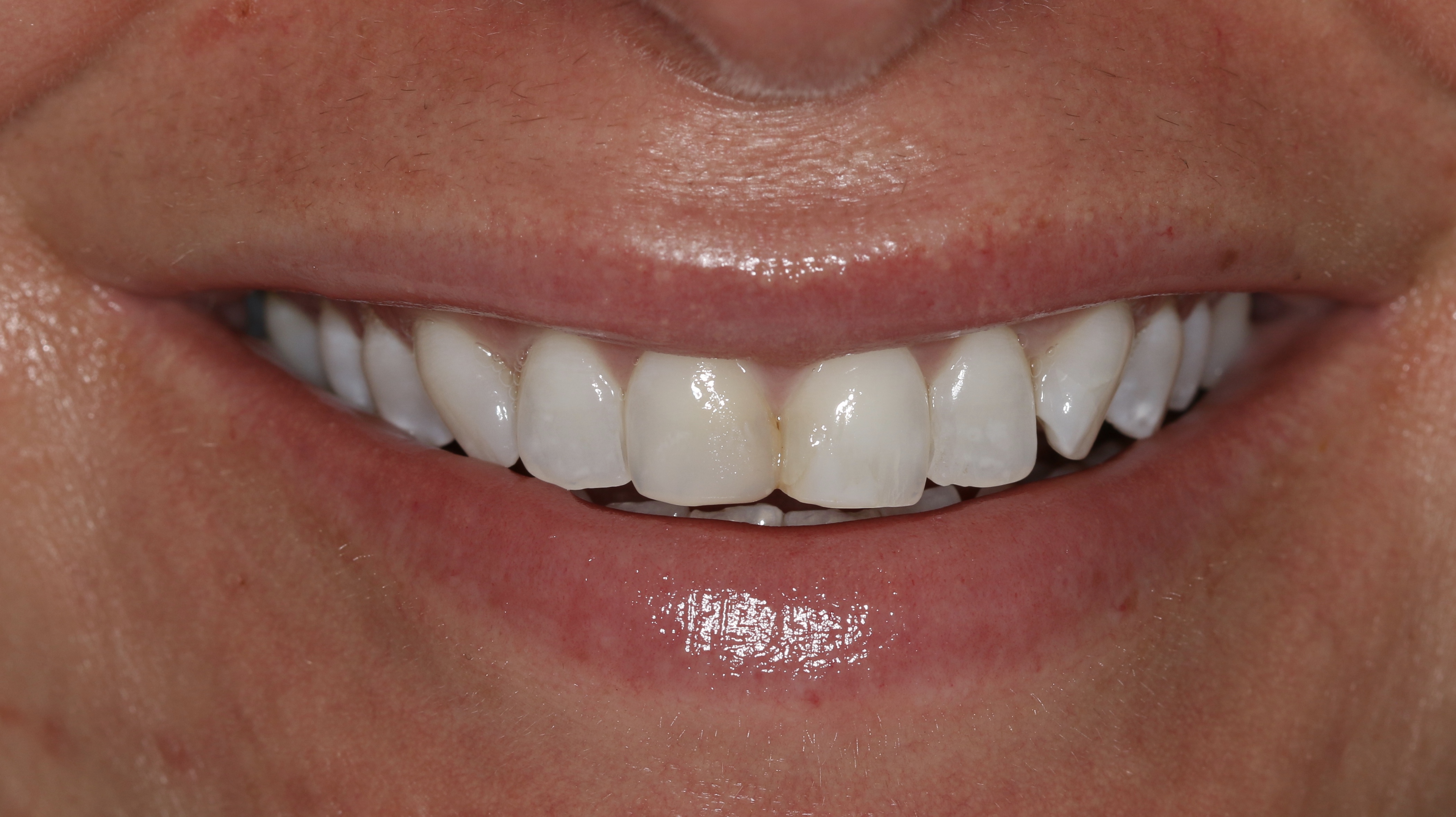 Georgetown Cosmetic Dentistry Georgetown Cosmetic Dentistry