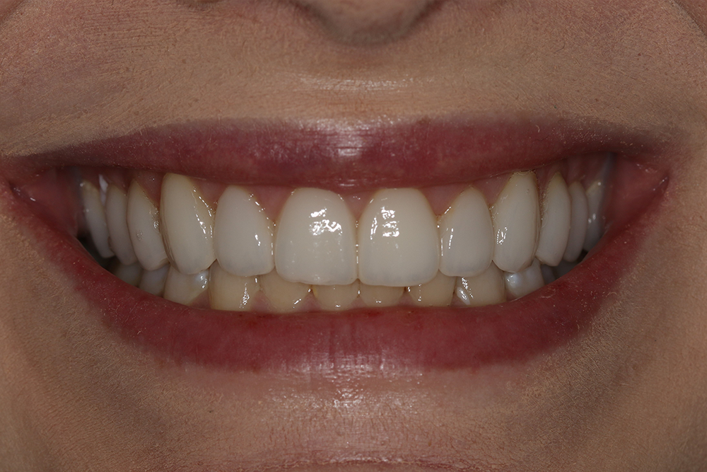 Georgetown Cosmetic Dentistry Georgetown Cosmetic Dentistry