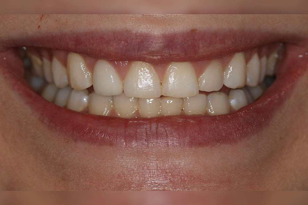 Georgetown Cosmetic Dentistry Georgetown Cosmetic Dentistry