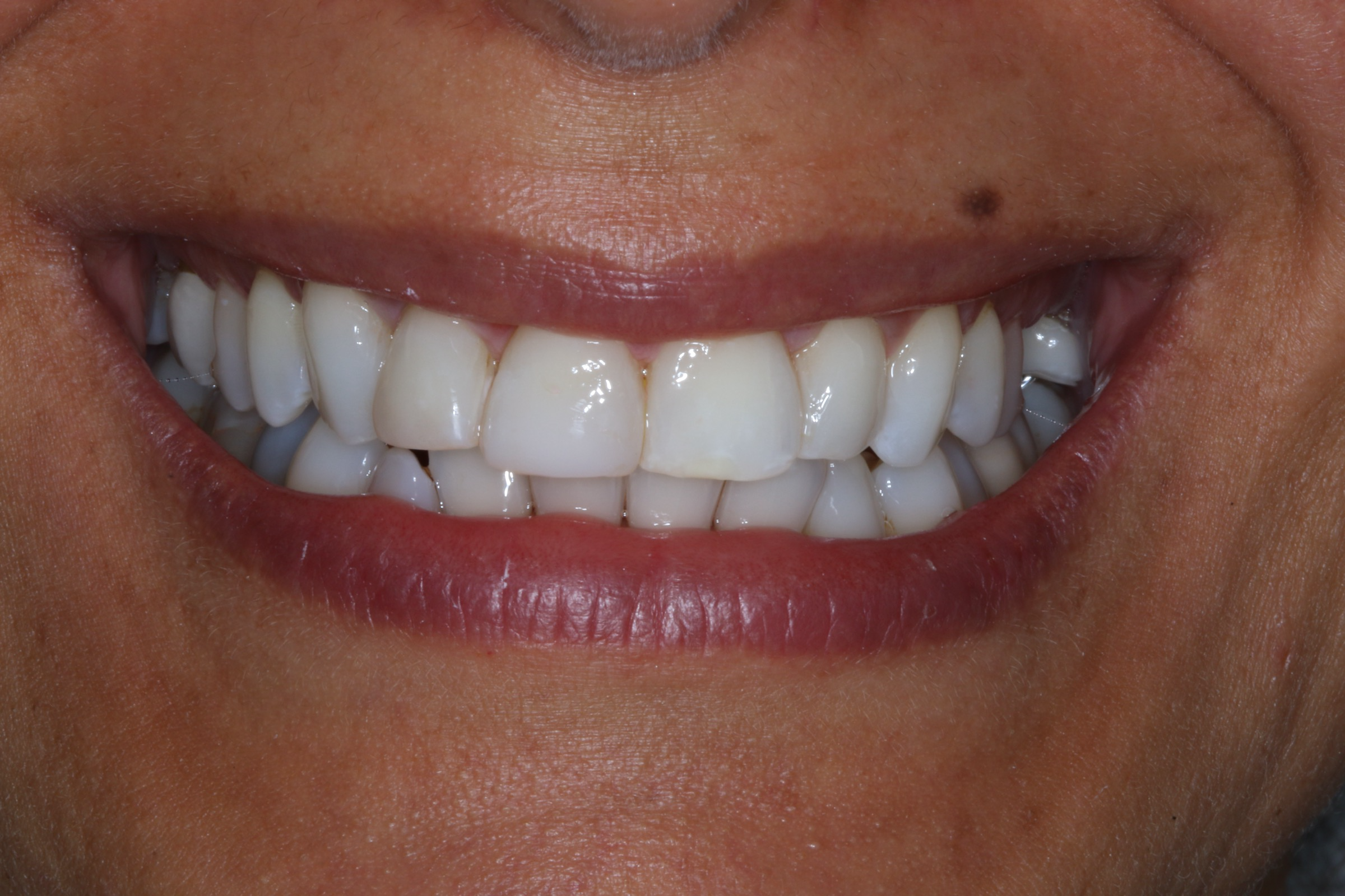 Georgetown Cosmetic Dentistry Georgetown Cosmetic Dentistry