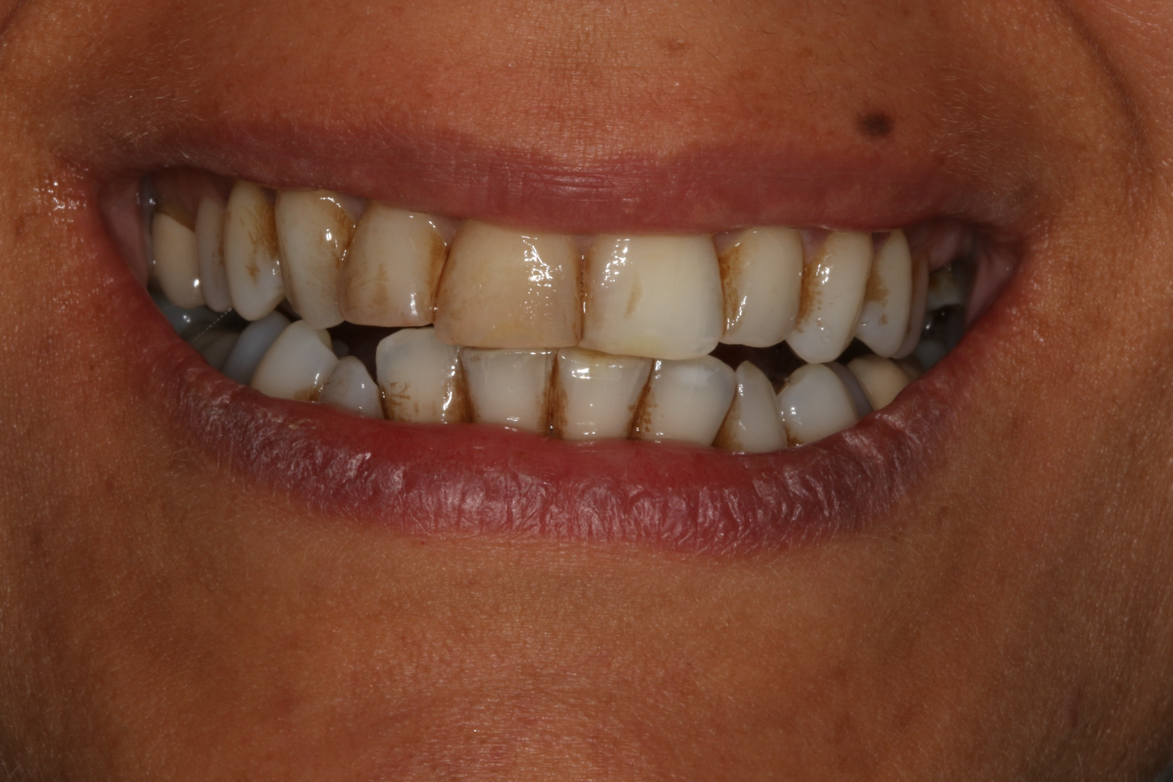 Georgetown Cosmetic Dentistry Georgetown Cosmetic Dentistry