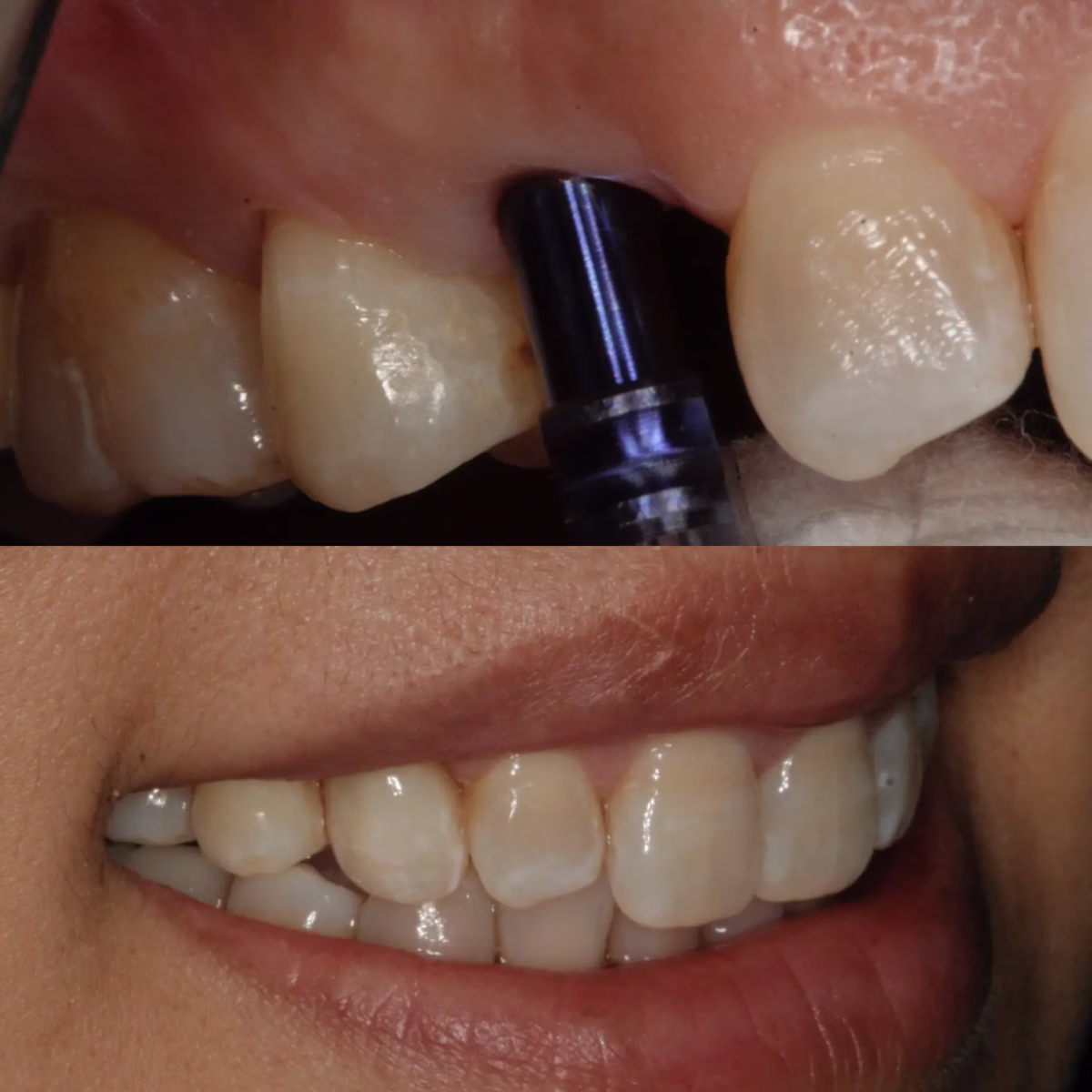 Dentistry Washington DC Dental Implants1
