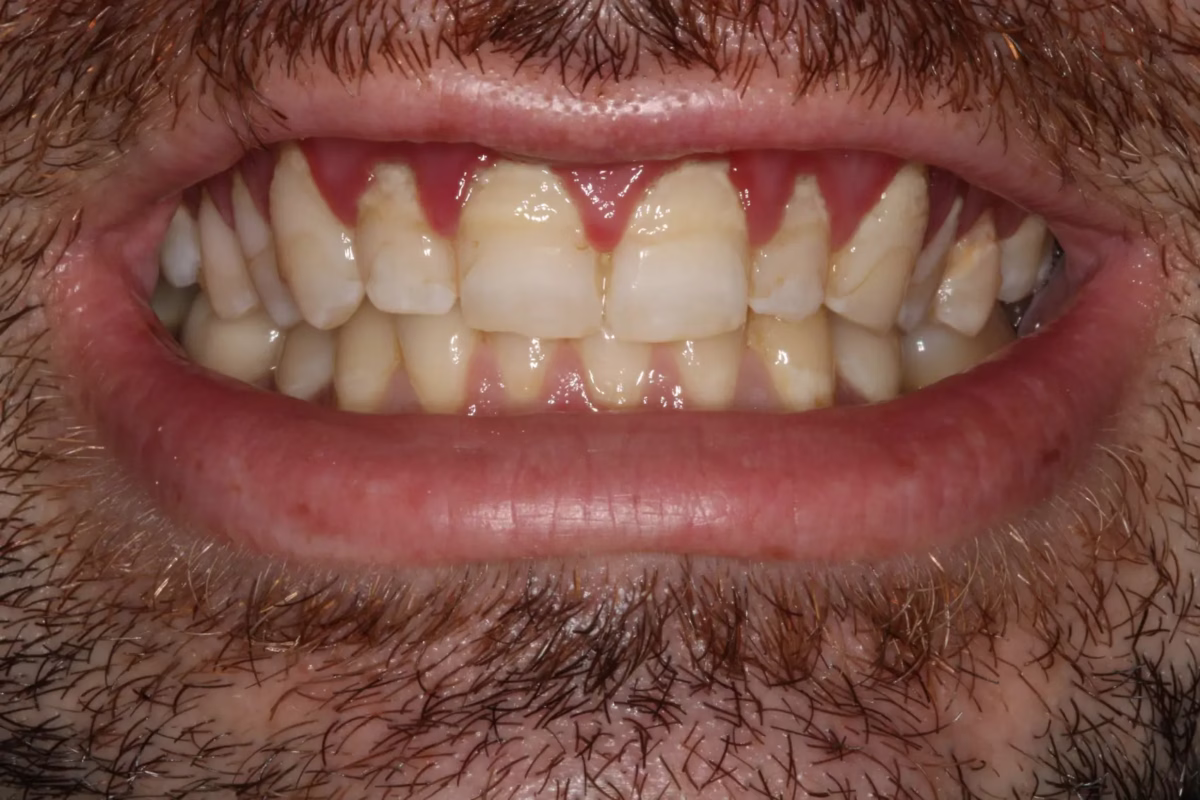 Dentistry Washington DC Dentistry Washington DC Before1