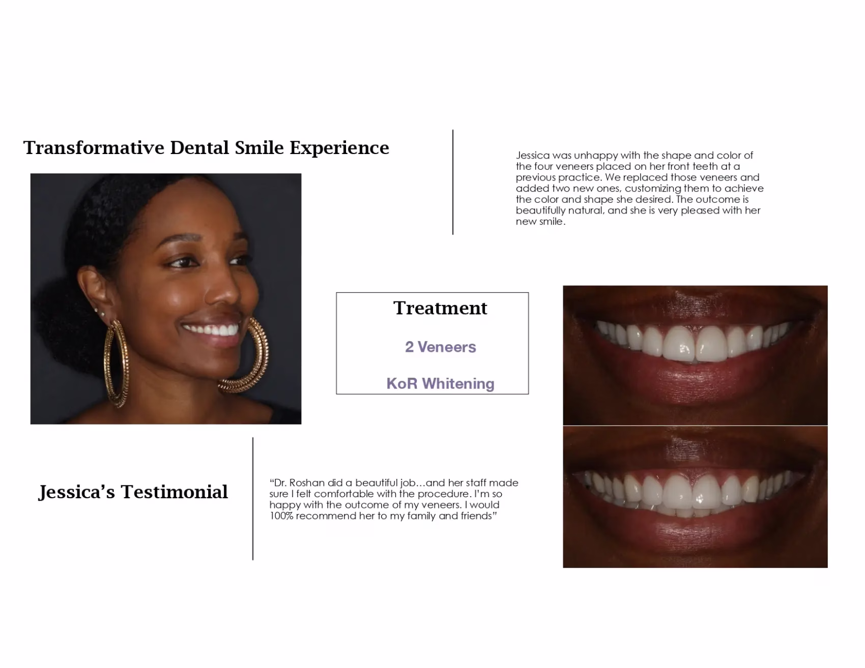 Dentistry Washington DC Jessicas Smile Story
