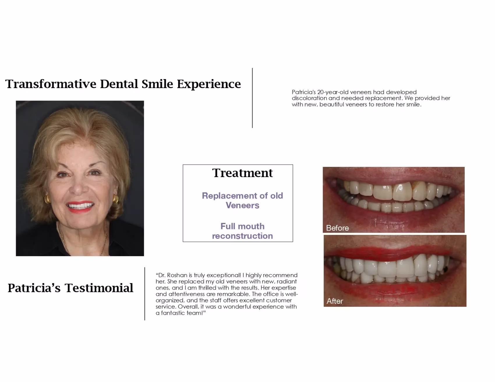 Dentistry Washington DC Patricias Smile Story 1