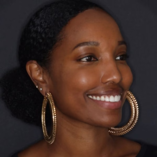 Dentistry Washington DC Smile Gallery Image16