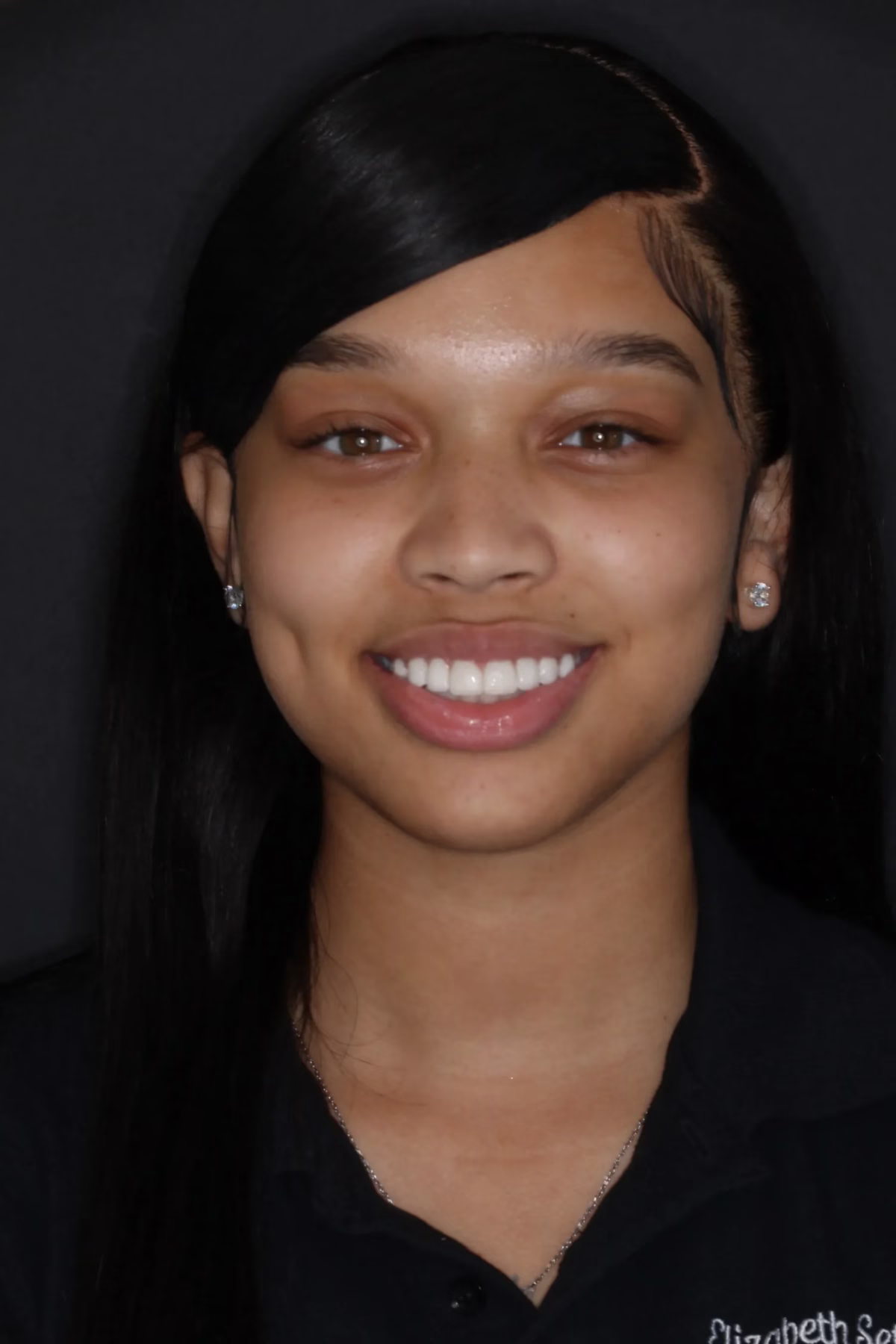 Dentistry Washington DC Smile Gallery Image20 scaled 1