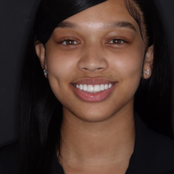 Georgetown Cosmetic Dentistry patient Whitening and Veneers